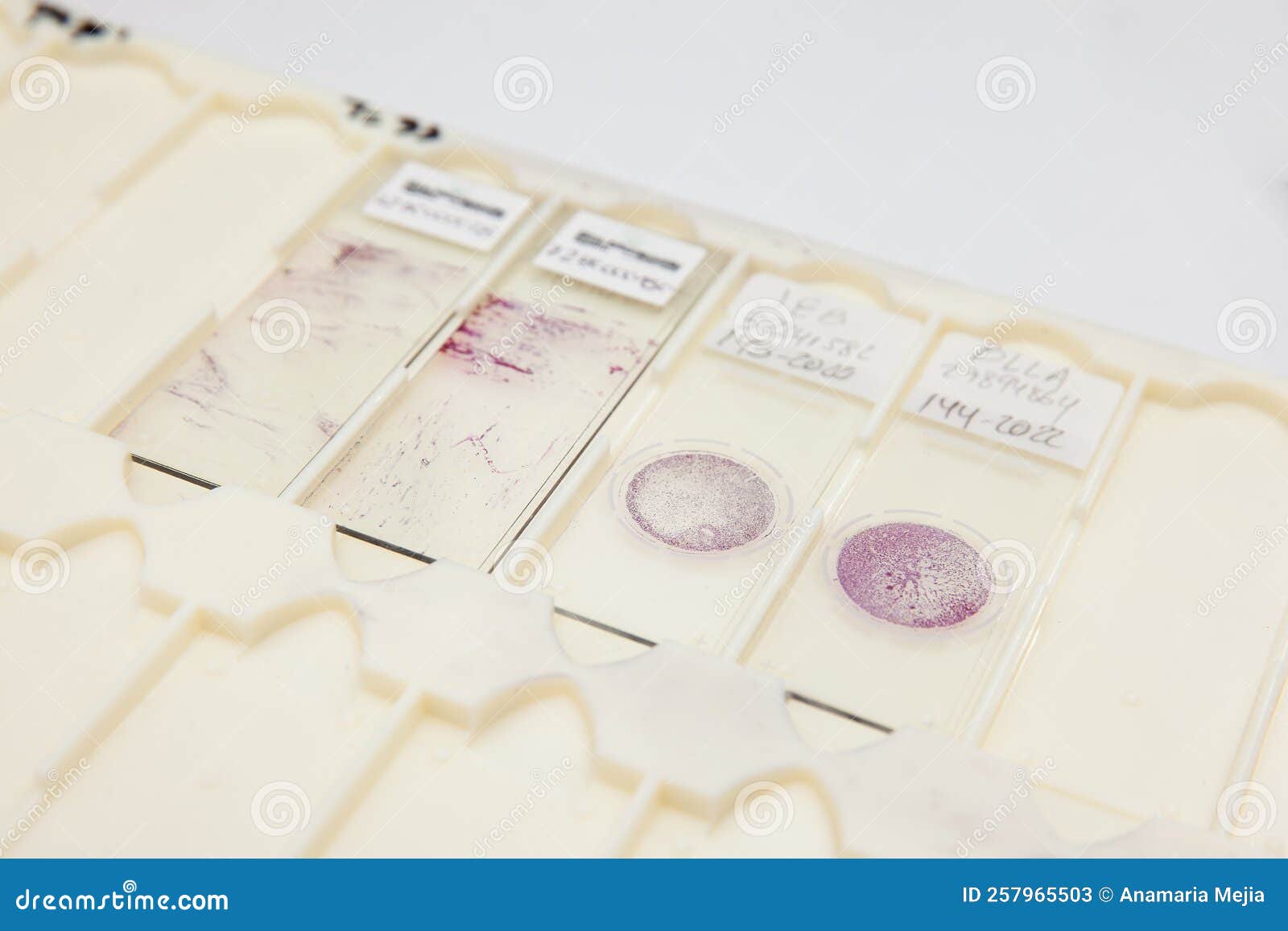 Traditional And Liquid Based Cytology Microscope Slides For Pap Smear traditional-and-liquid-based-cytology-microscope-slides-for-pap-smear