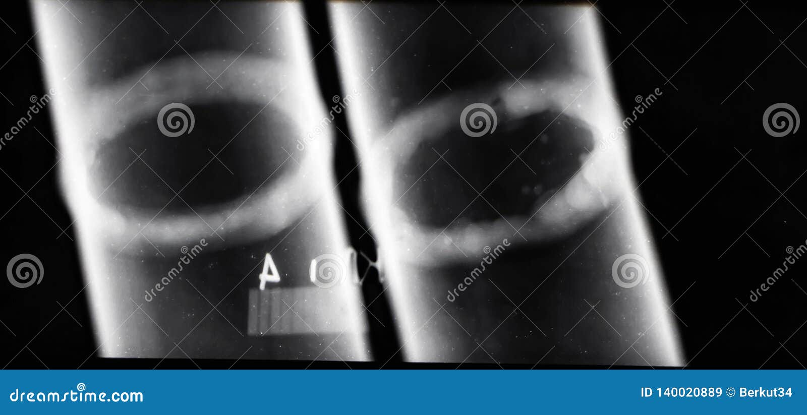 x-ray images of welds of pipelines to identify defective areas