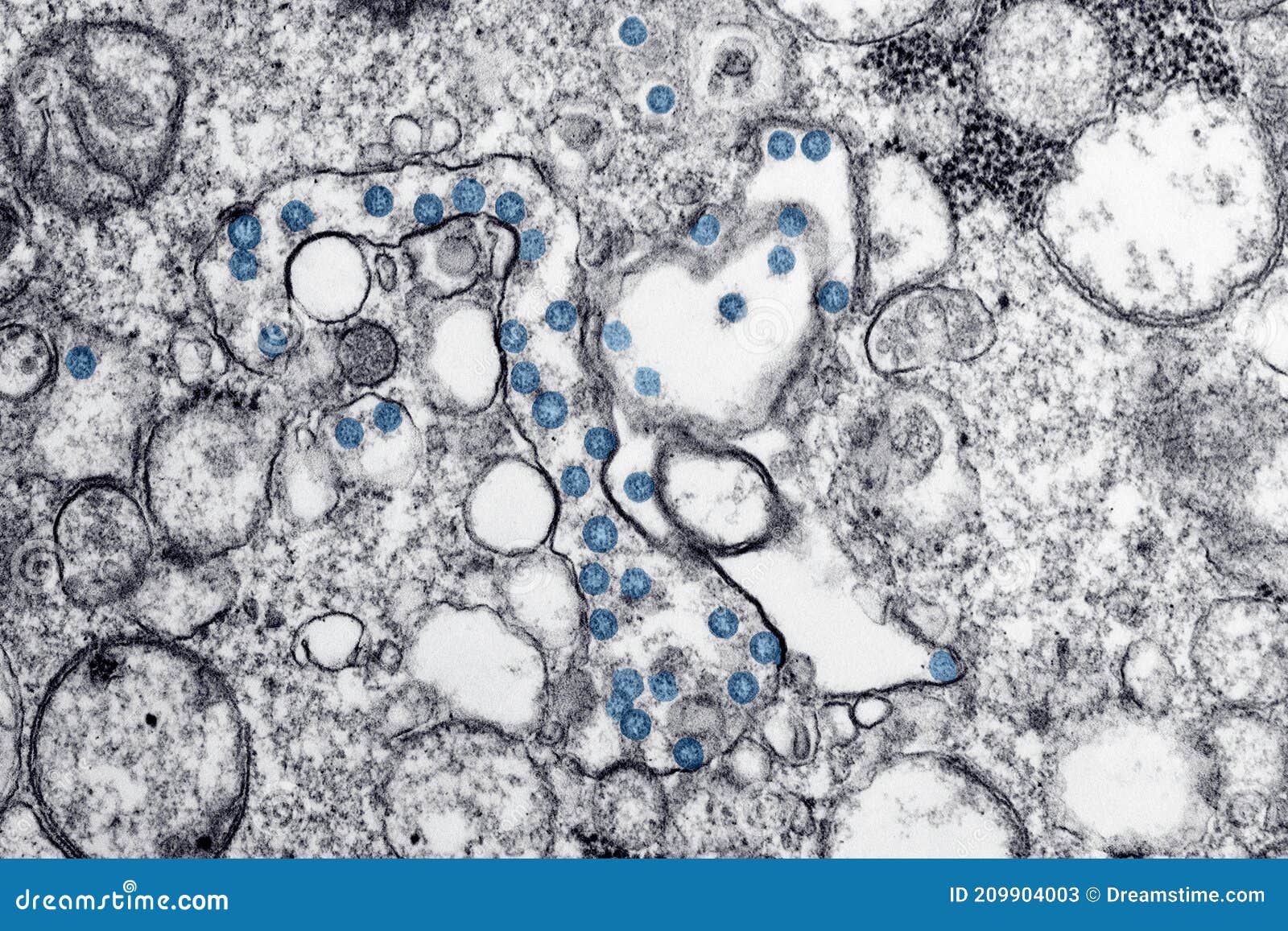 transmission electron microscope image of covid 19 virus