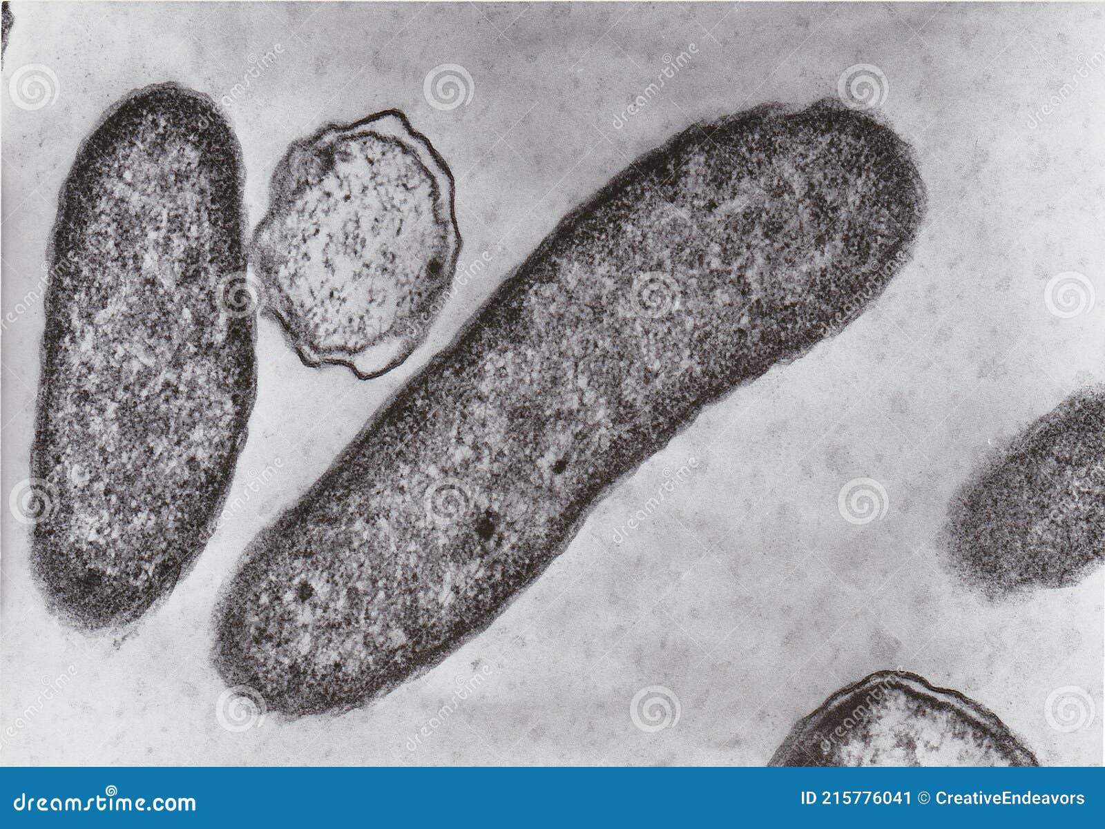 Transmission Electron Microscope Photo of Vibrio Bacteria X76000 Stock