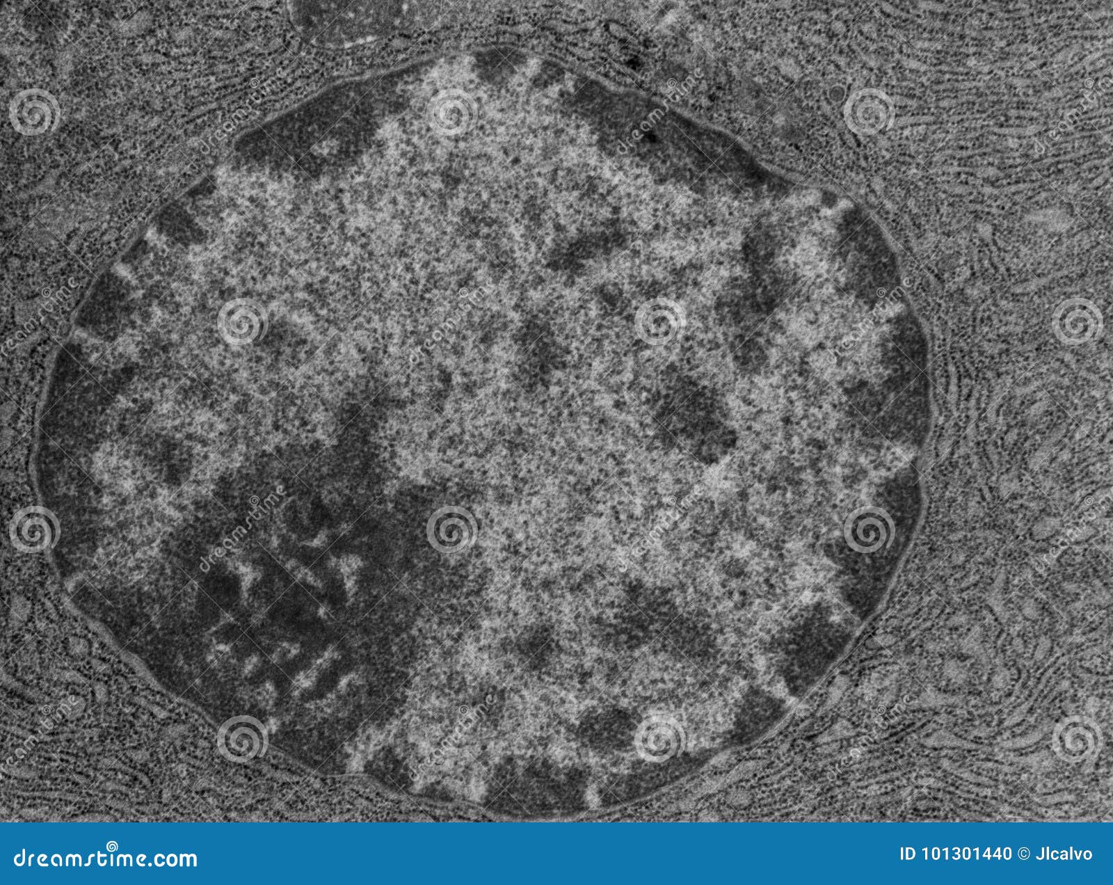 Label this transmission electron micrograph