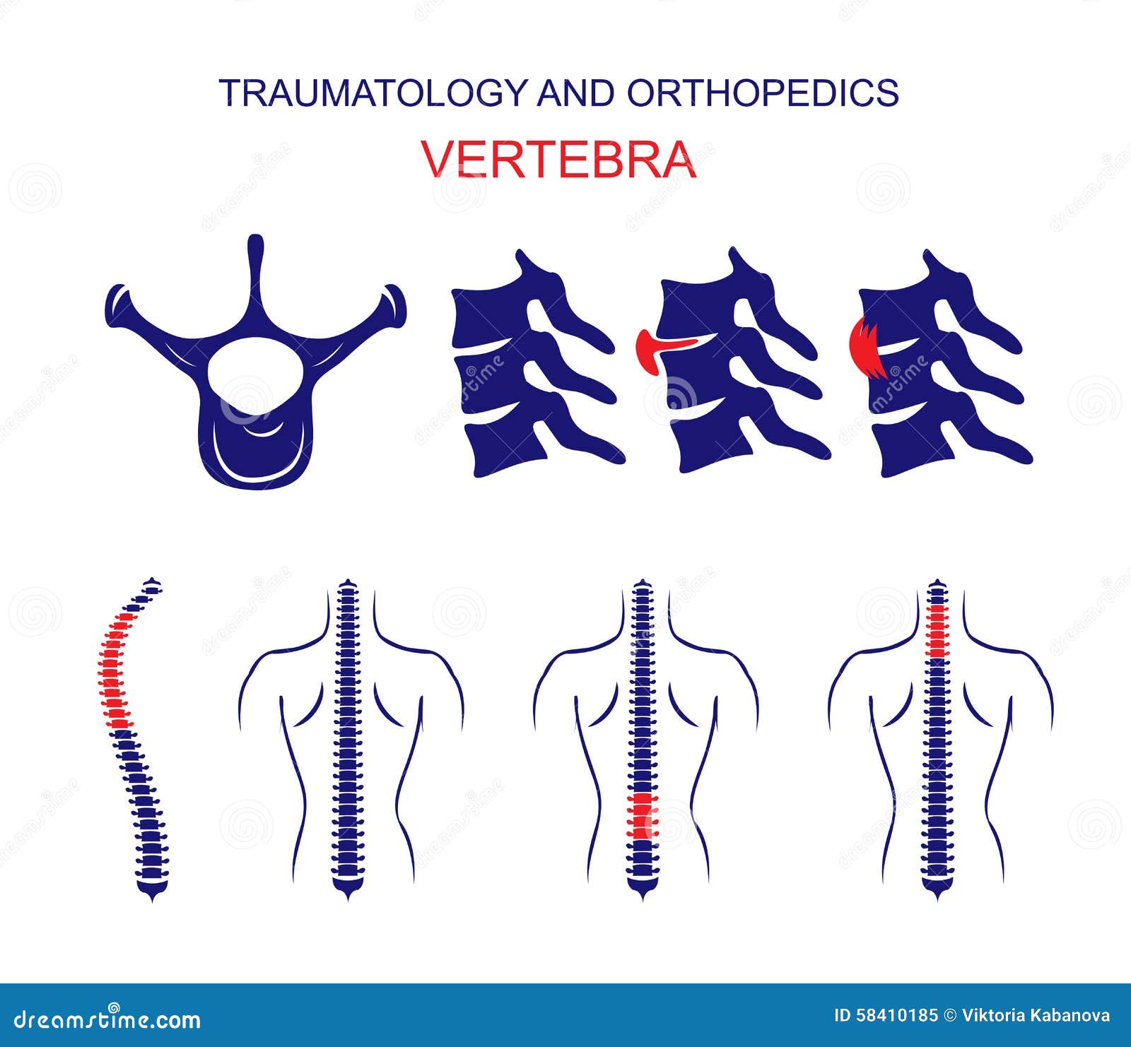 traumatology and orthopedics. the spine. vertebra.