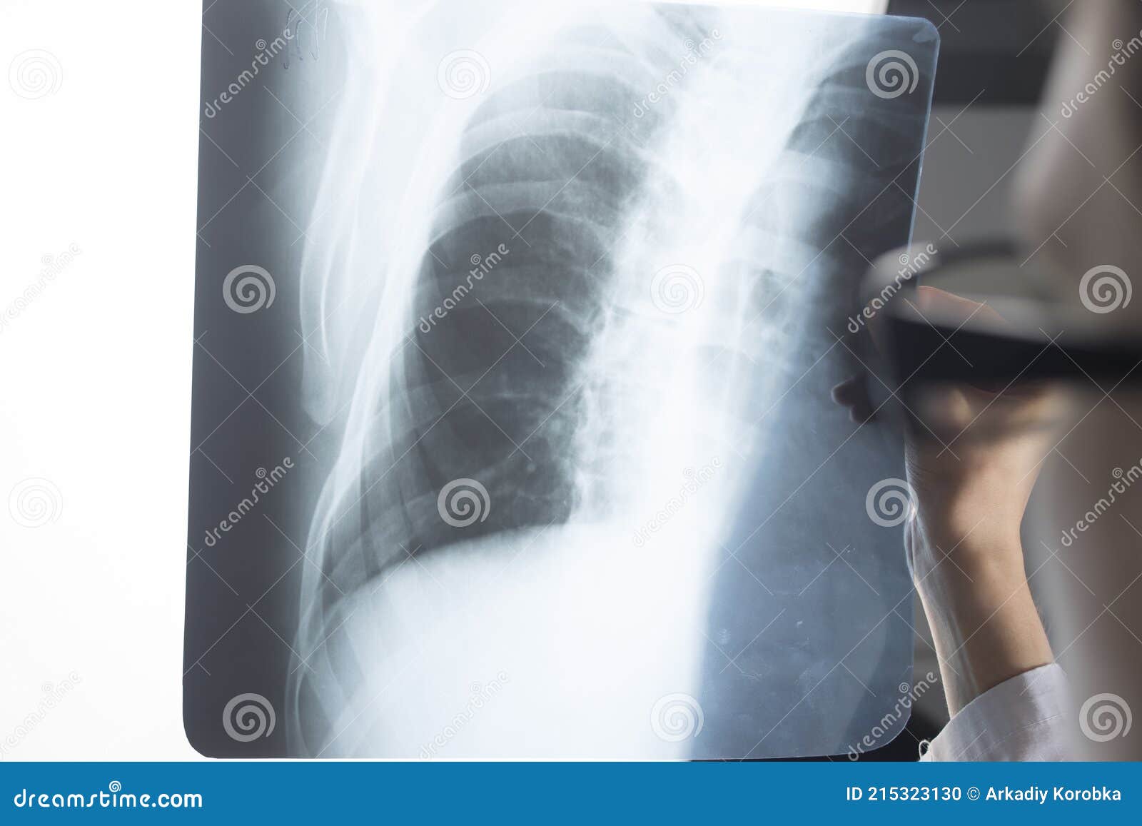 traumatology surgeon roentgenogram x-ray