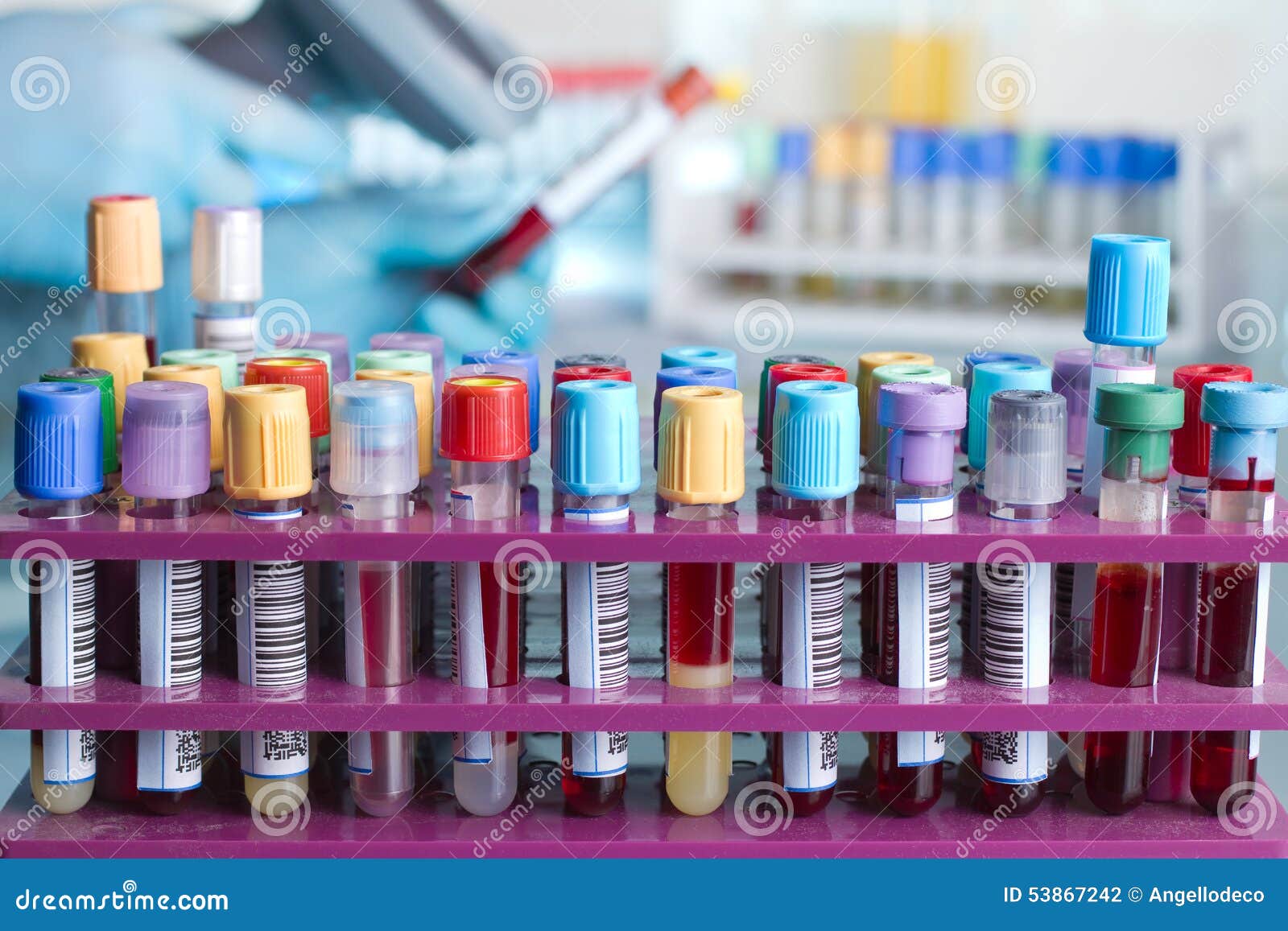 Tray With Tubes With Blood Samples Labeled Stock Photo Image 53867242