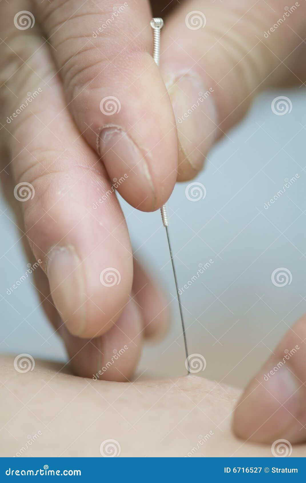 Treatment by acupuncture stock image. Image of body, medicative 6716527