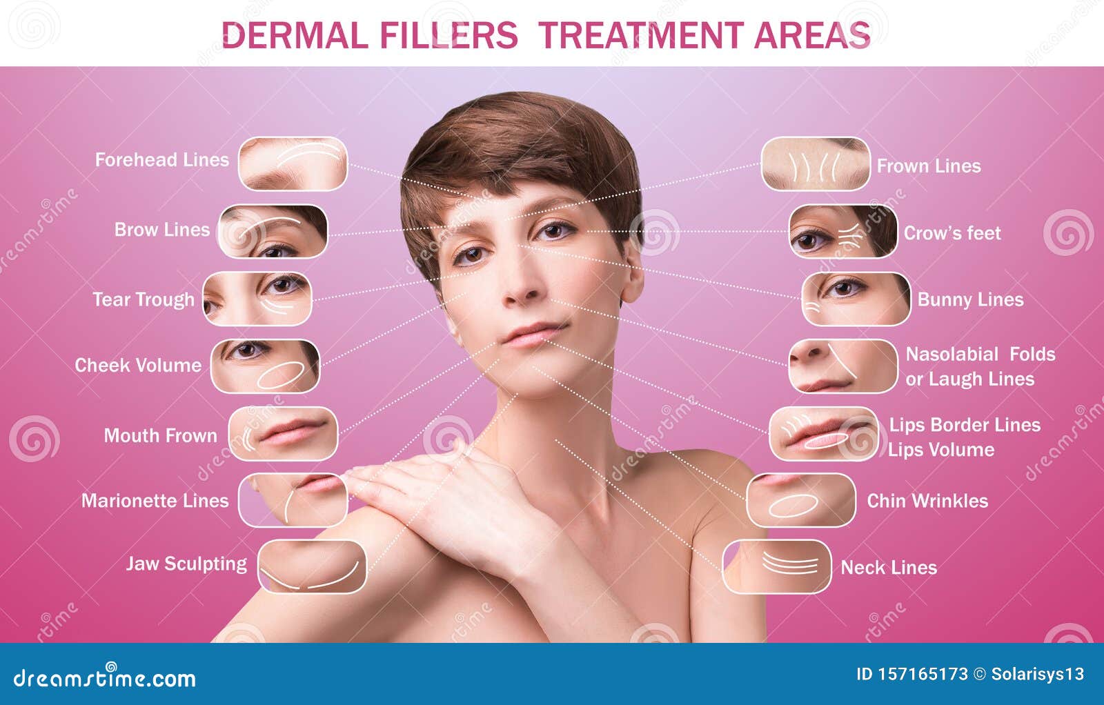 treatment areas for anti-wrinkle injection.