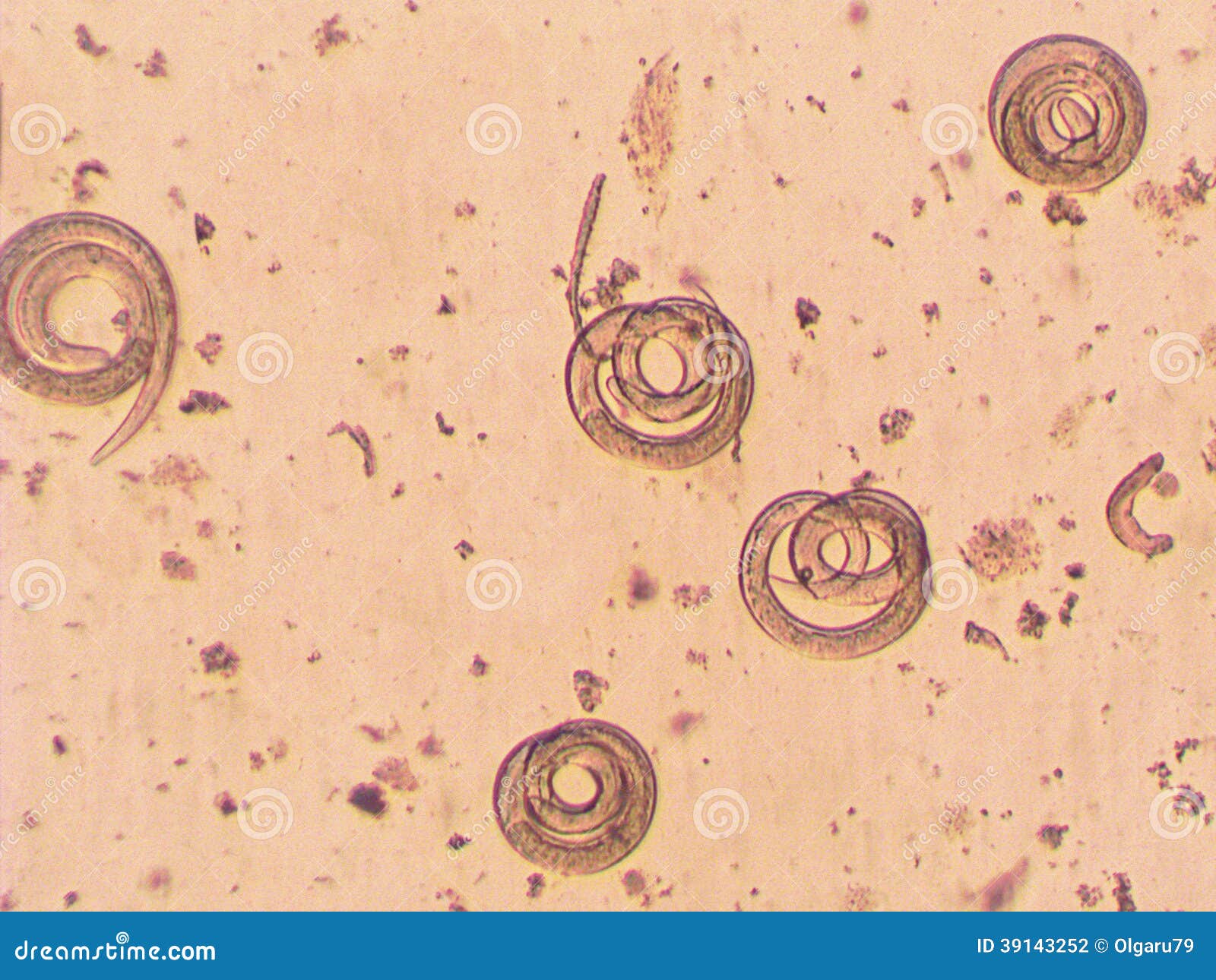 trichinella spiralis - parasitic worm microscope