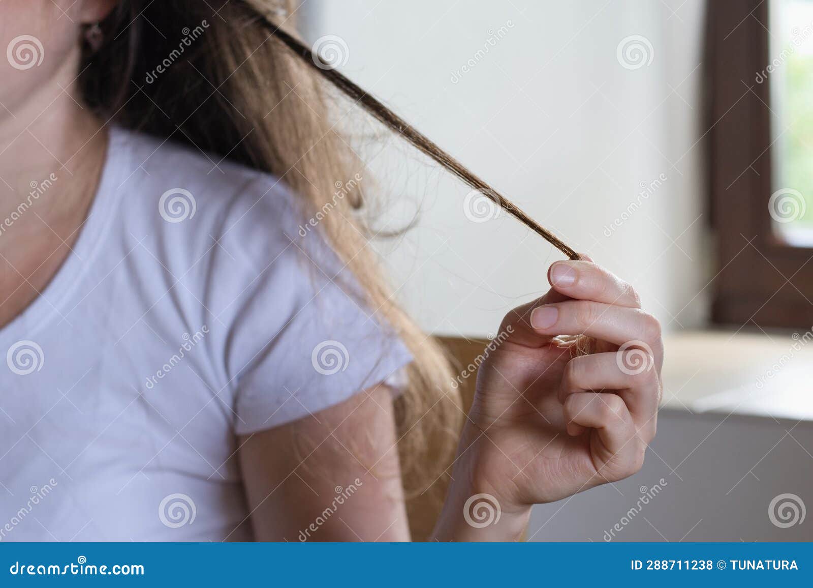 Trichotillomania Concept. Human Impulse Behavioral Problem,hair Pulling Disorder Stock Photo