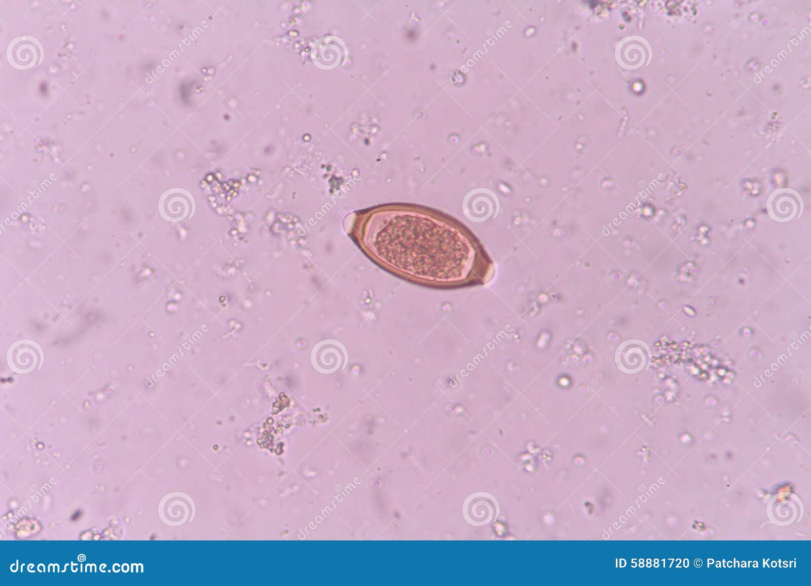 Trichuris trichiura stock photo. Image of microscopic 58881720