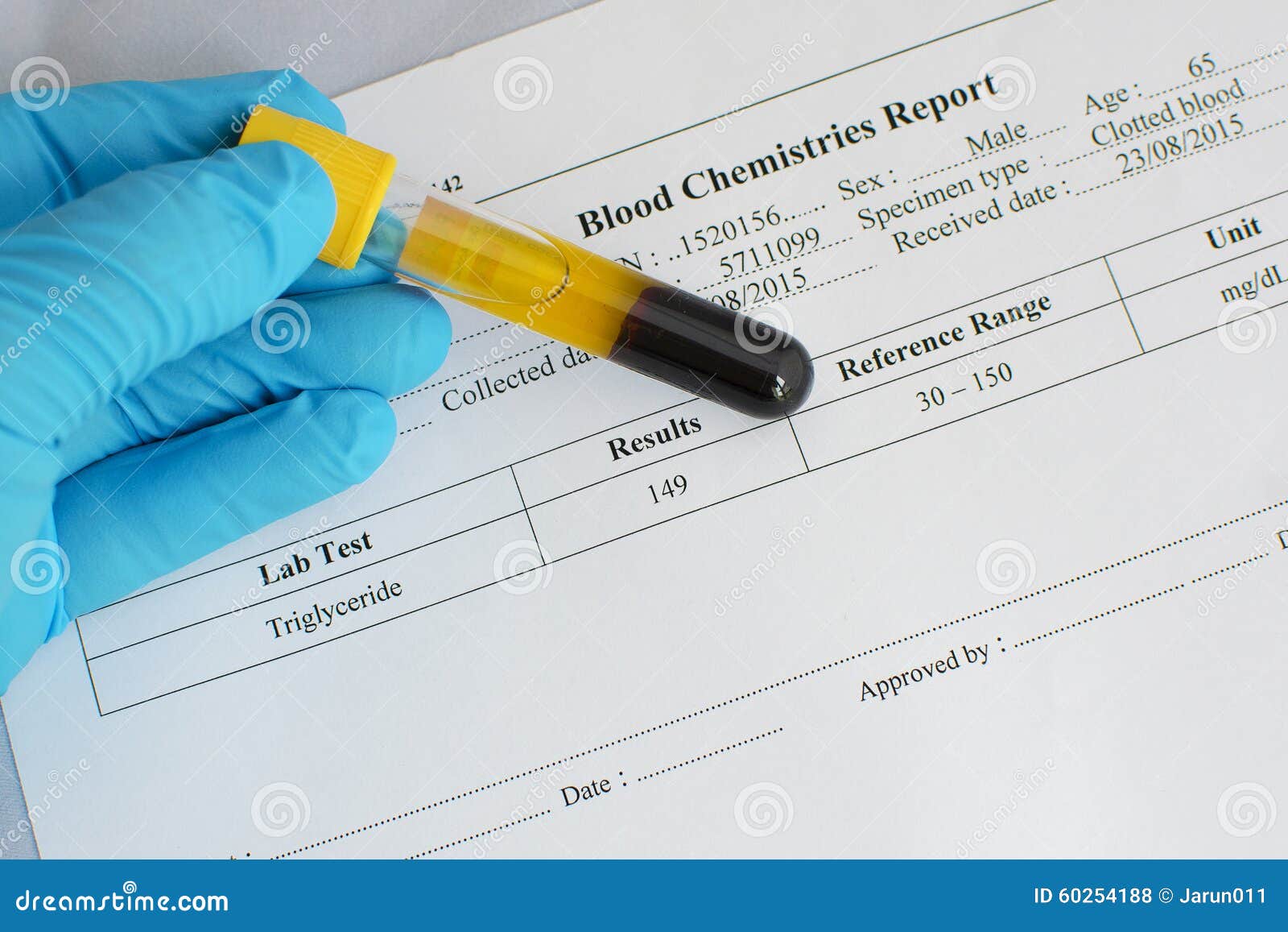 Triglyceride Testing Result Normal Royalty Free Stock Image triglyceride-testing-result-normal-royalty-free-stock-image