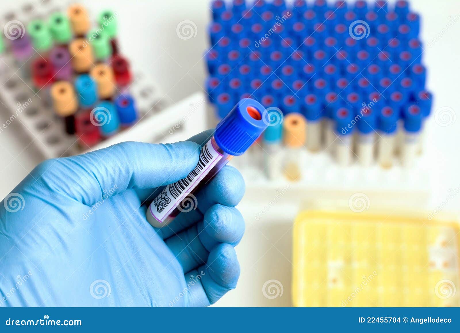Tube of blood stock photo. Image of chemistry, antibiotic 22455704