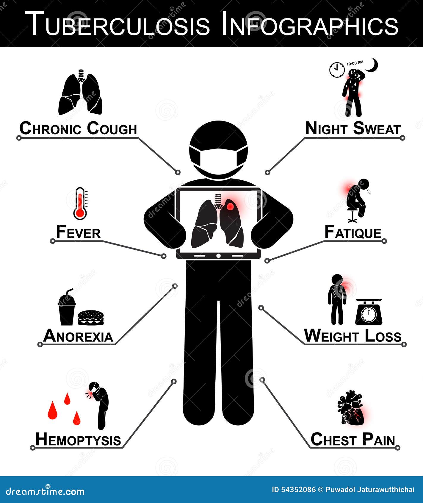 tuberculosis infographics