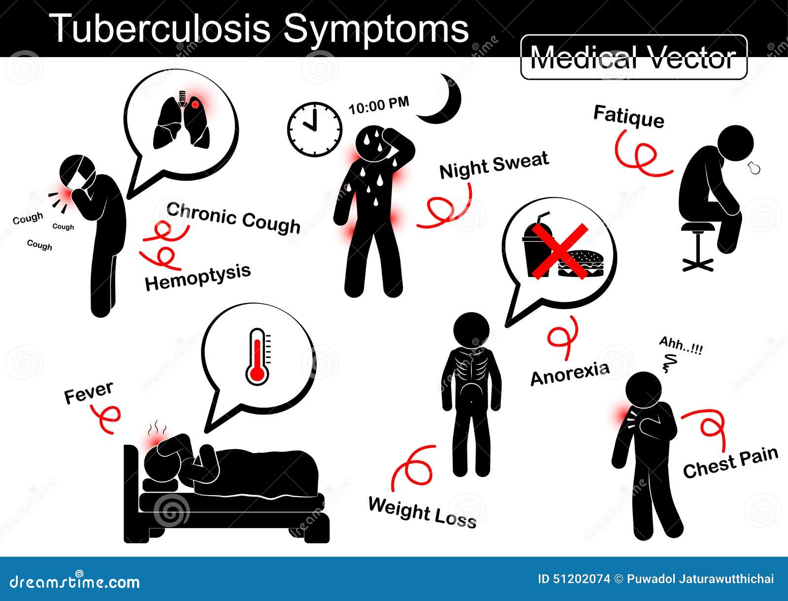 Tuberculosis TB Stock Photo | CartoonDealer.com #84220038