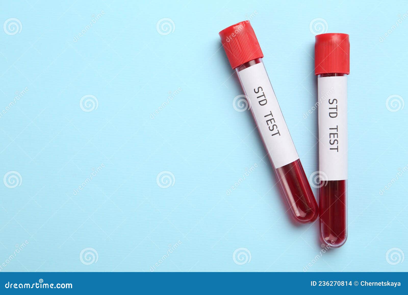 Tubes with Blood Samples and Labels STD Test on Light Blue Background