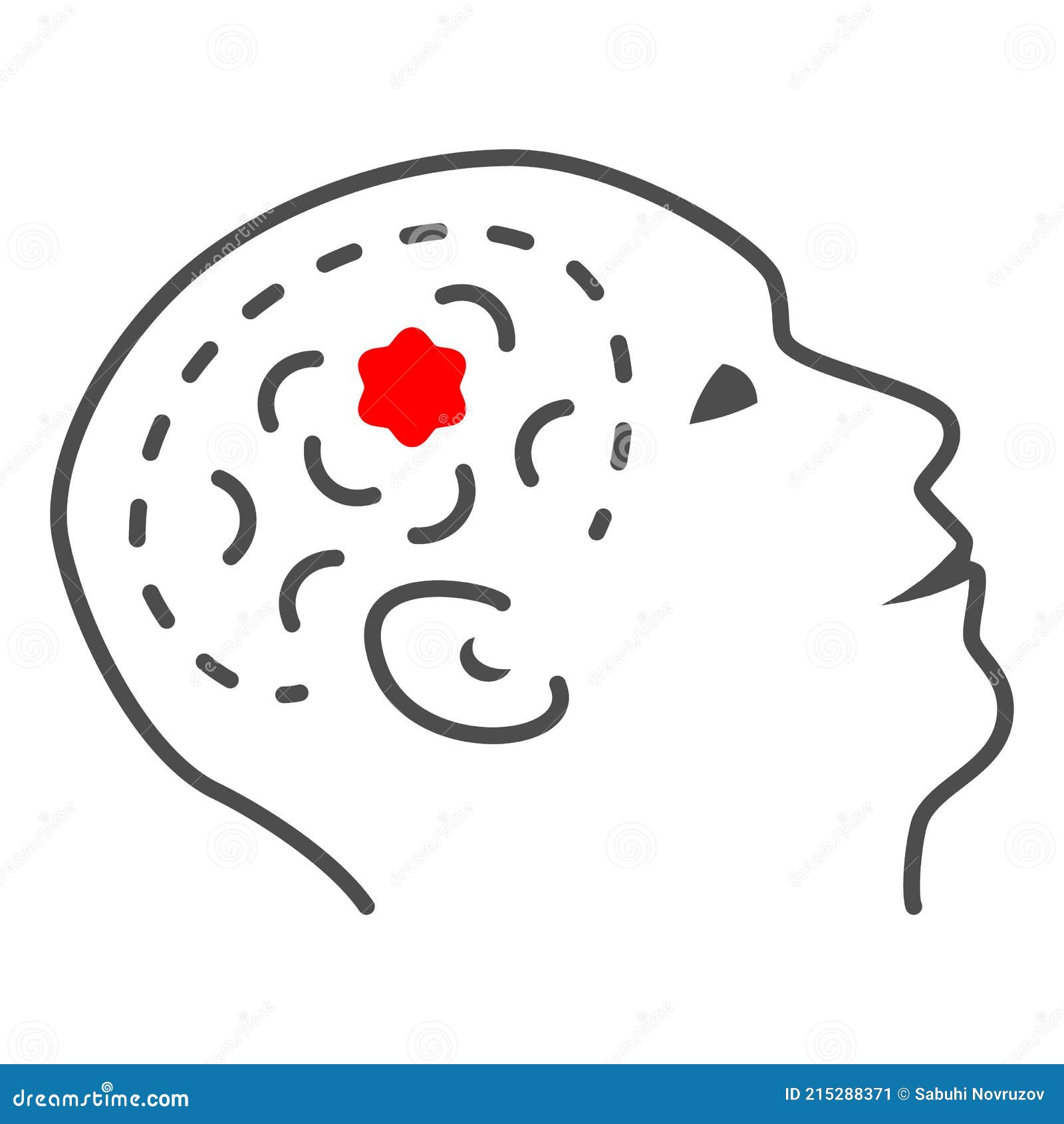Tumor In Gehirn Dunnen Linie Symbol Menschliche Krankheiten Konzept Kopfschmerzen Und Migrane Zeichen Auf Weissem Hintergrund Gehir Vektor Abbildung Illustration Von Zeile Medizin 215288371