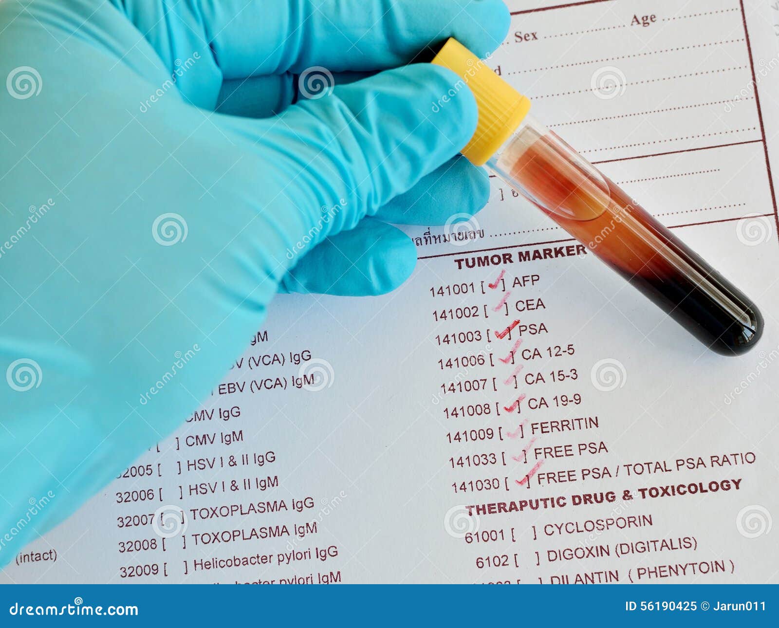 Tumor maker testing stock image. Image of hospital, healthcare 56190425