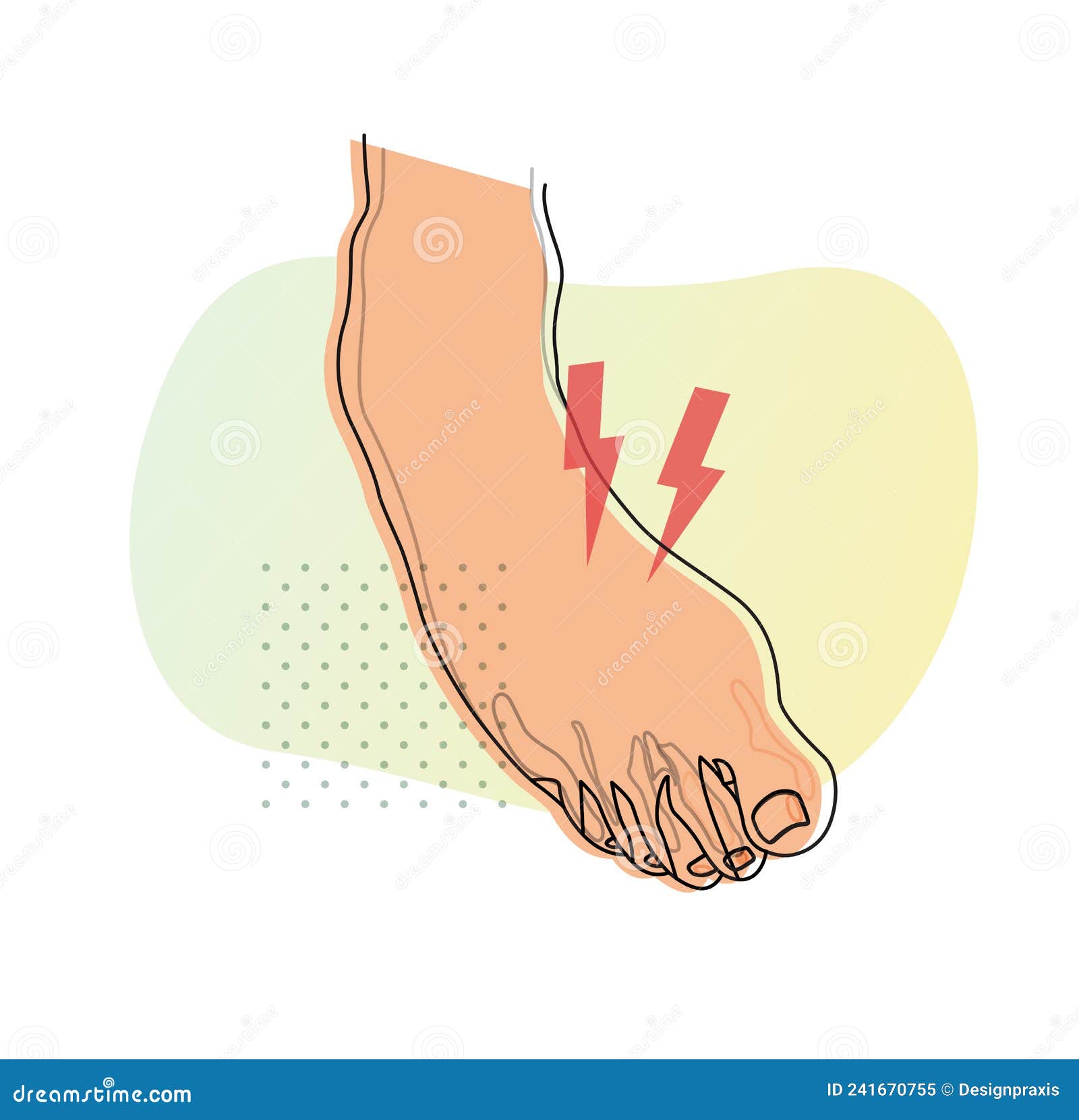 Twisted Foot- Ankle Sprain - Illustration Stock Vector - Illustration of  joint, injury: 241670755