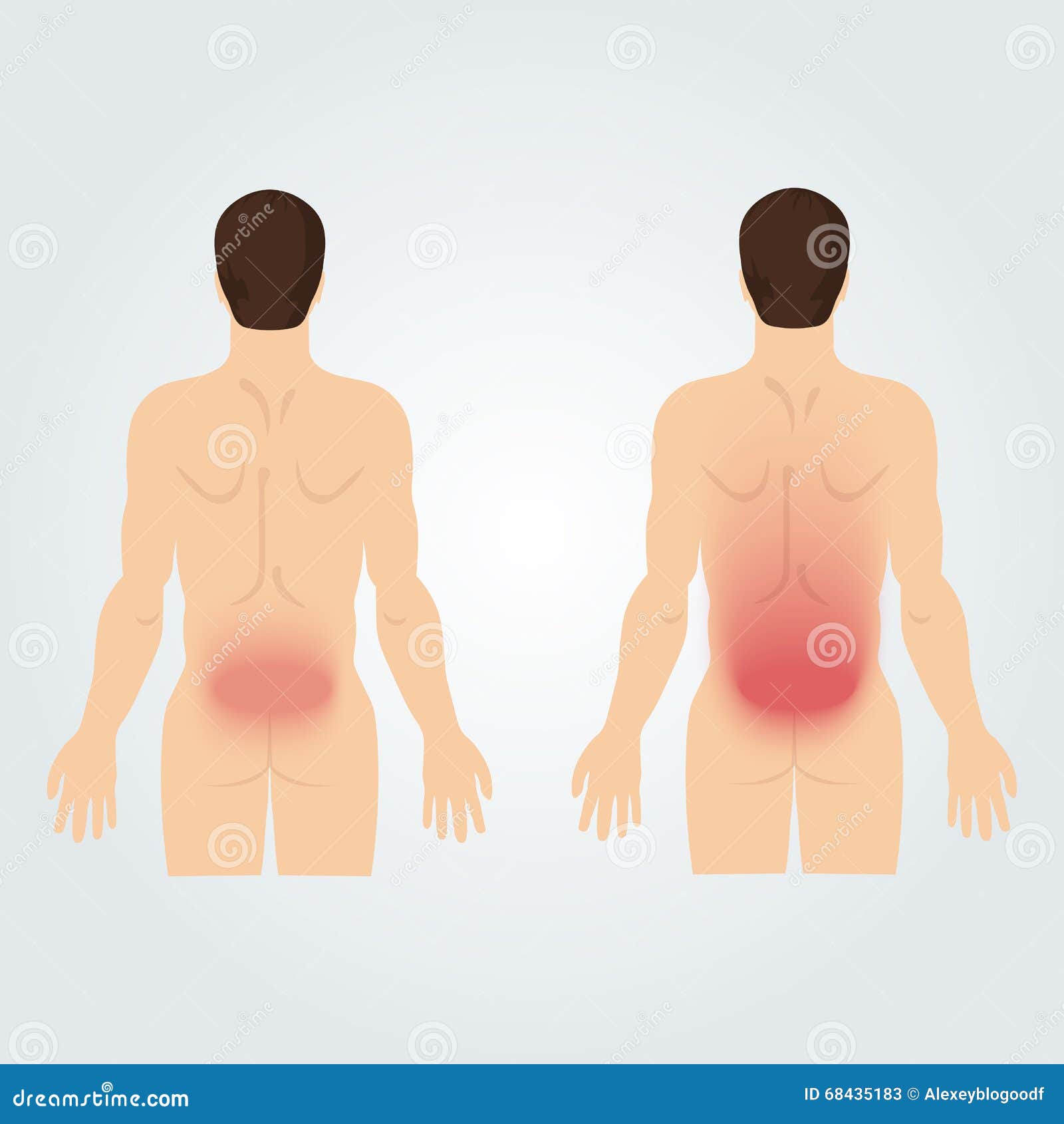 Flank Pain Stock Illustrations – 34 Flank Pain Stock Illustrations, Vectors  & Clipart - Dreamstime