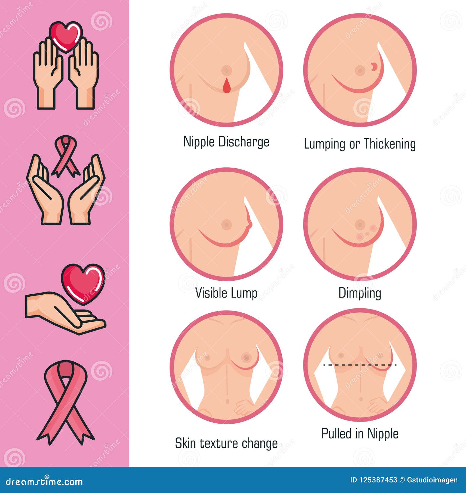 Types of Appearances of the Breast Stock Vector - Illustration of cure,  checking: 125387453