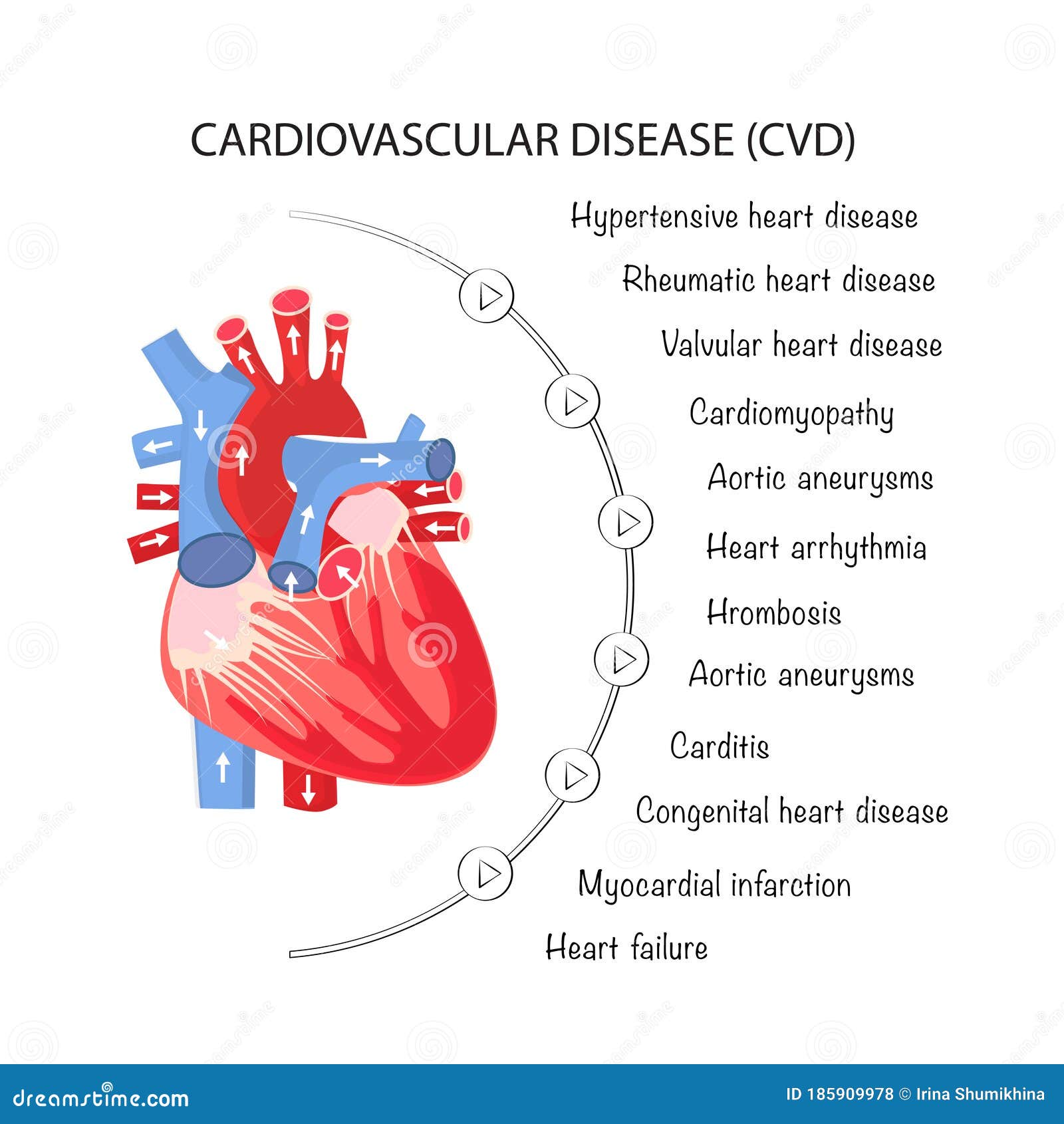 Types of Cardiovascular Diseases on a Poster for Interns and Medical