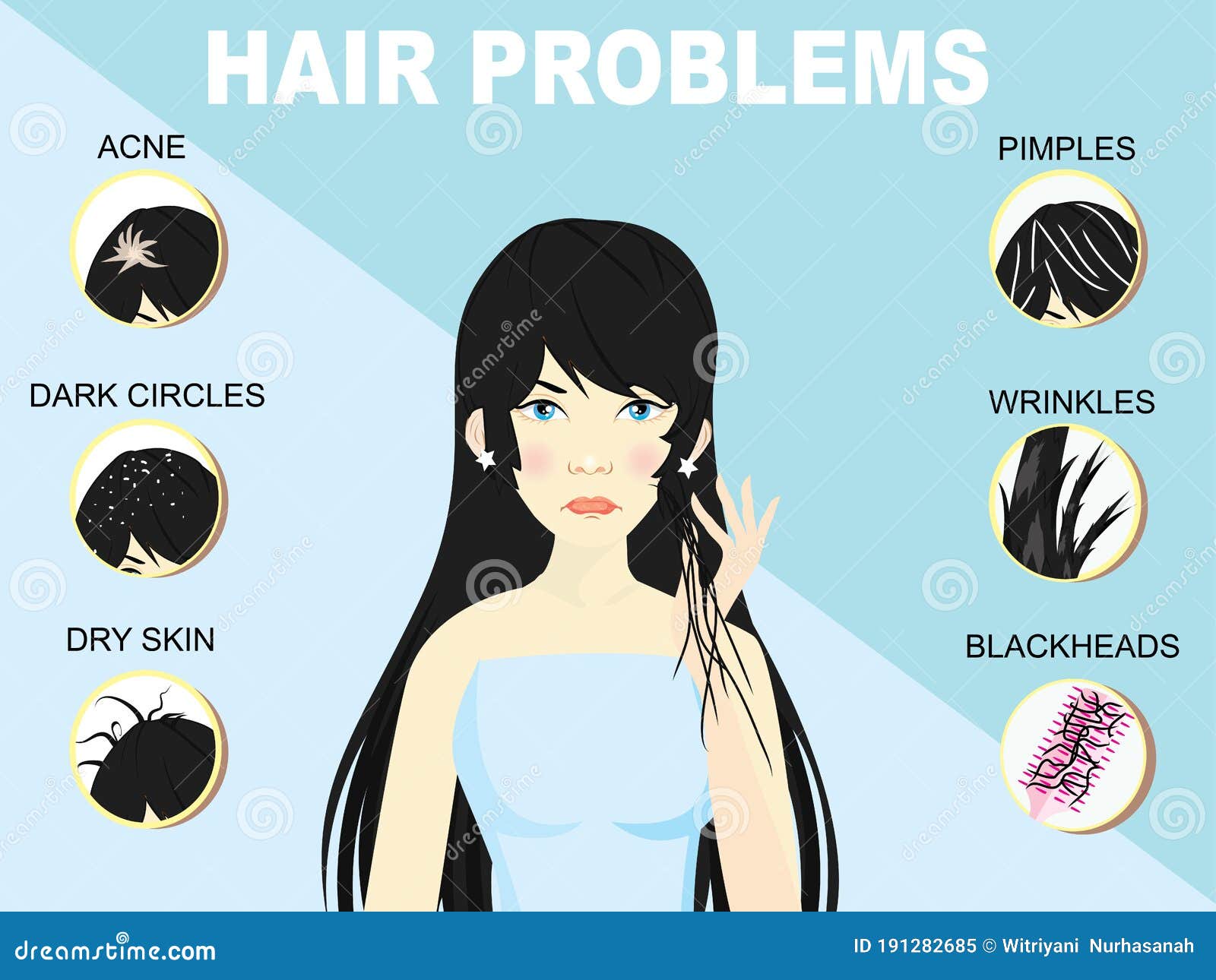 Types of Hair Problem, Alopecia, Damage, Gray Hair Stock Vector -  Illustration of beautiful, lifestyle: 191282685