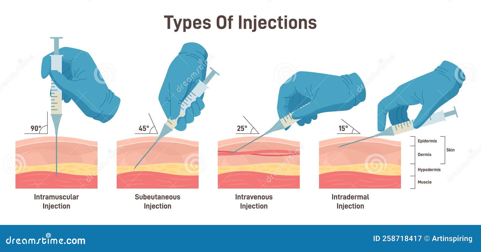 Types of Injections. Guide To Injecting Medication into Skin Stock ...