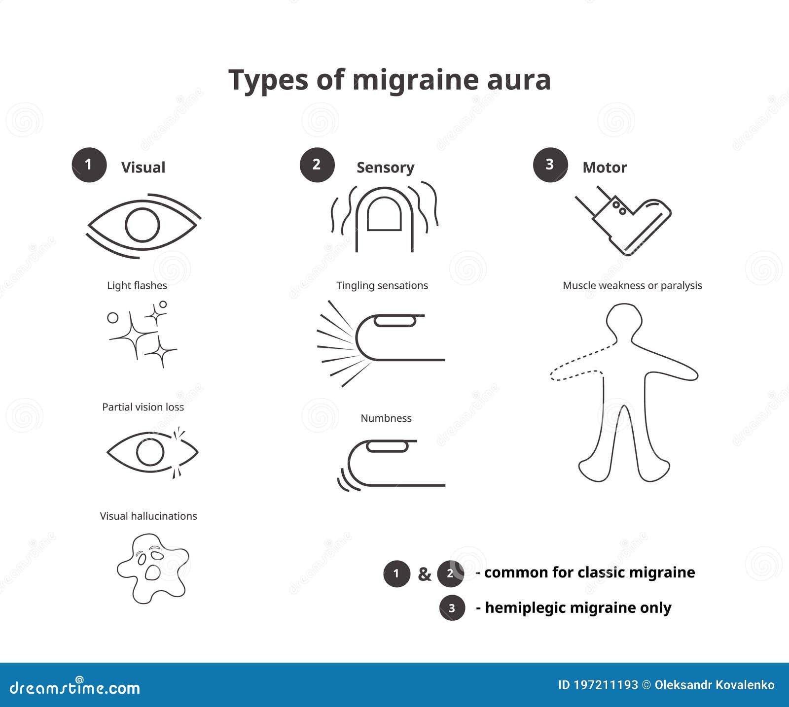 Types of Migraine Aura. Sensory, Visual and Motor Aura of the Classic Types of Migraine Aura. Sensory, Visual and Motor Aura of the Classic