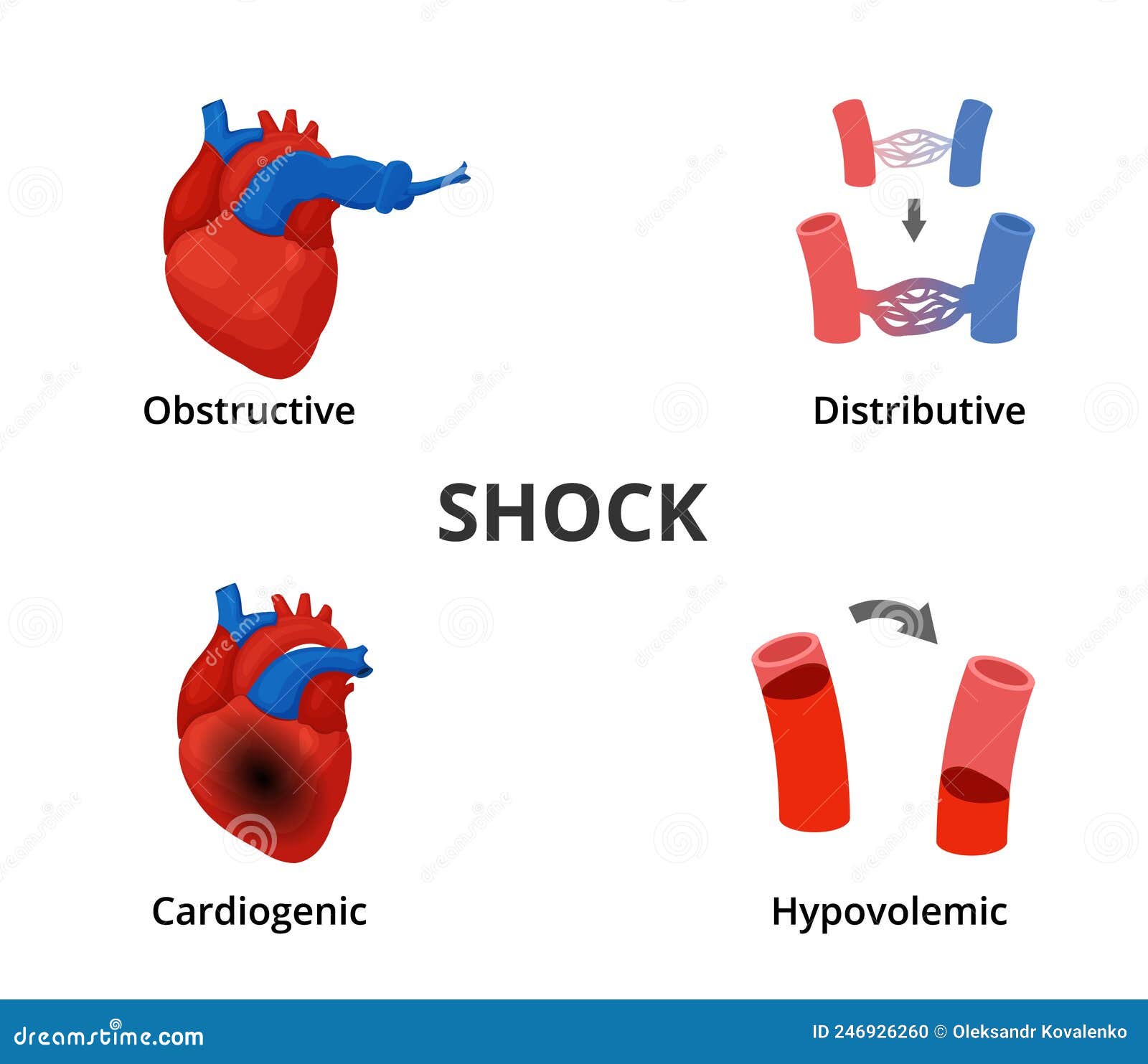 4 types of shock diagram. medical emergency infographics