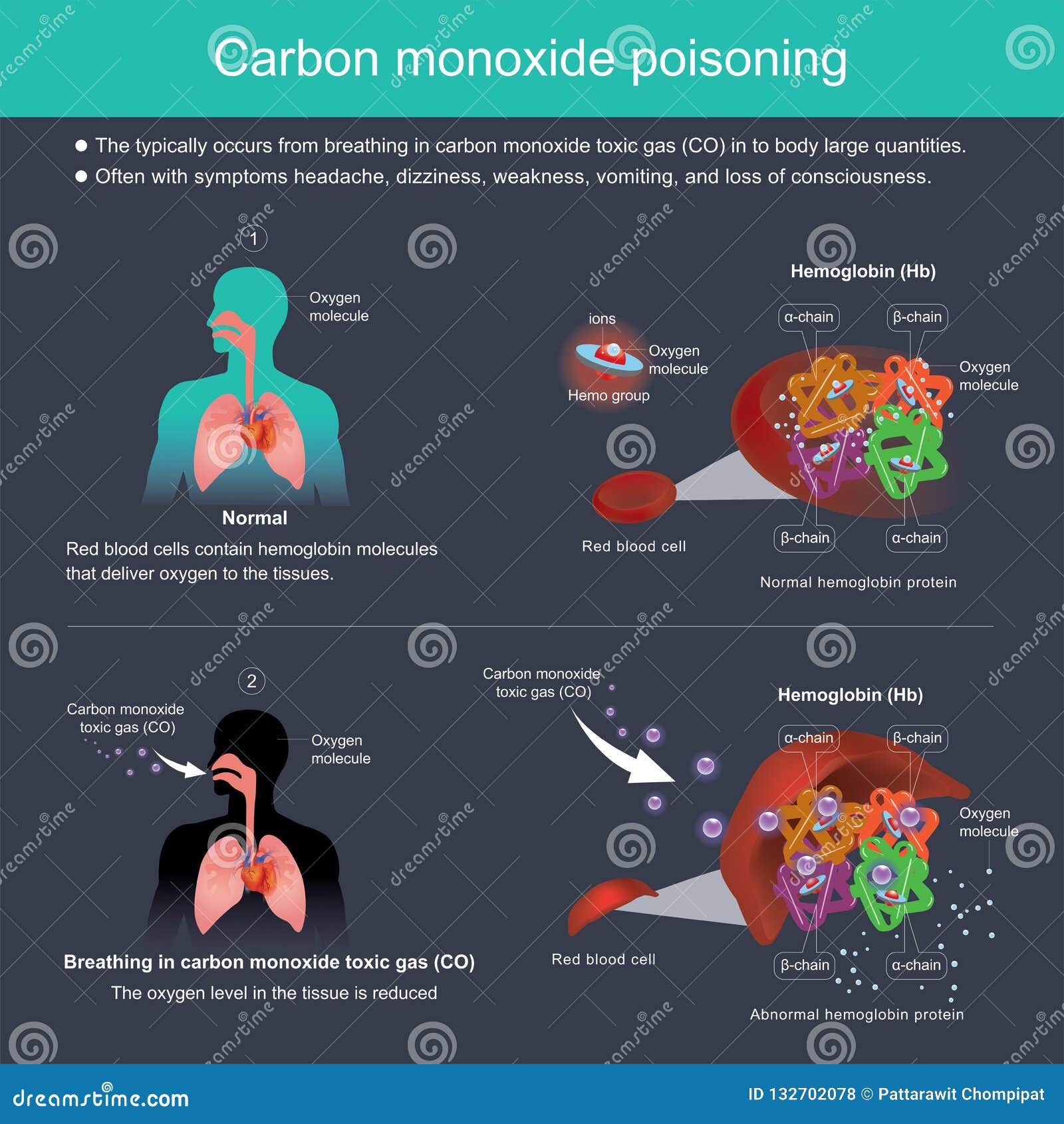carbon monoxide symptoms reddit carbon monoxide symptoms reddit