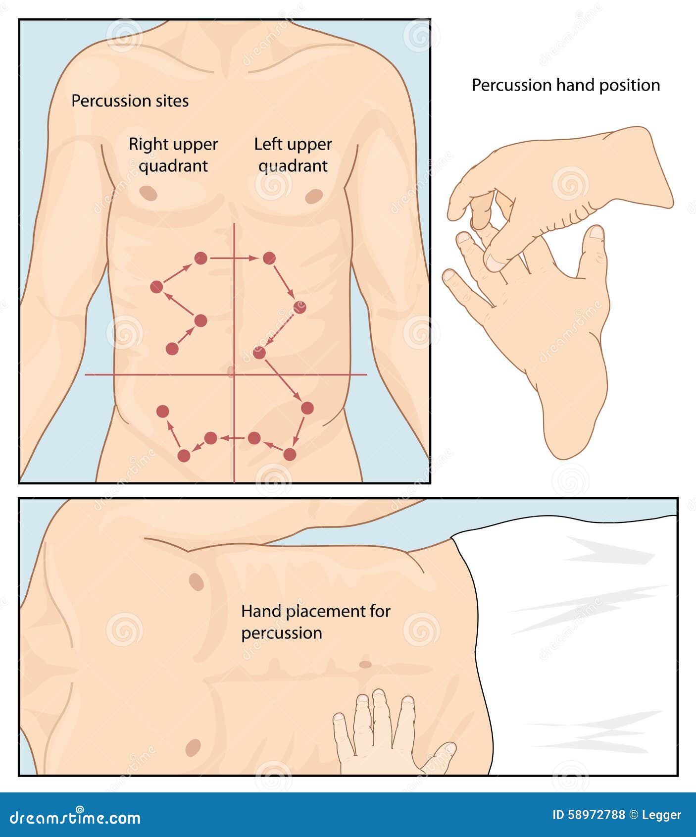 Técnica Abdominal Da Percussão Ilustração do Vetor Ilustração de