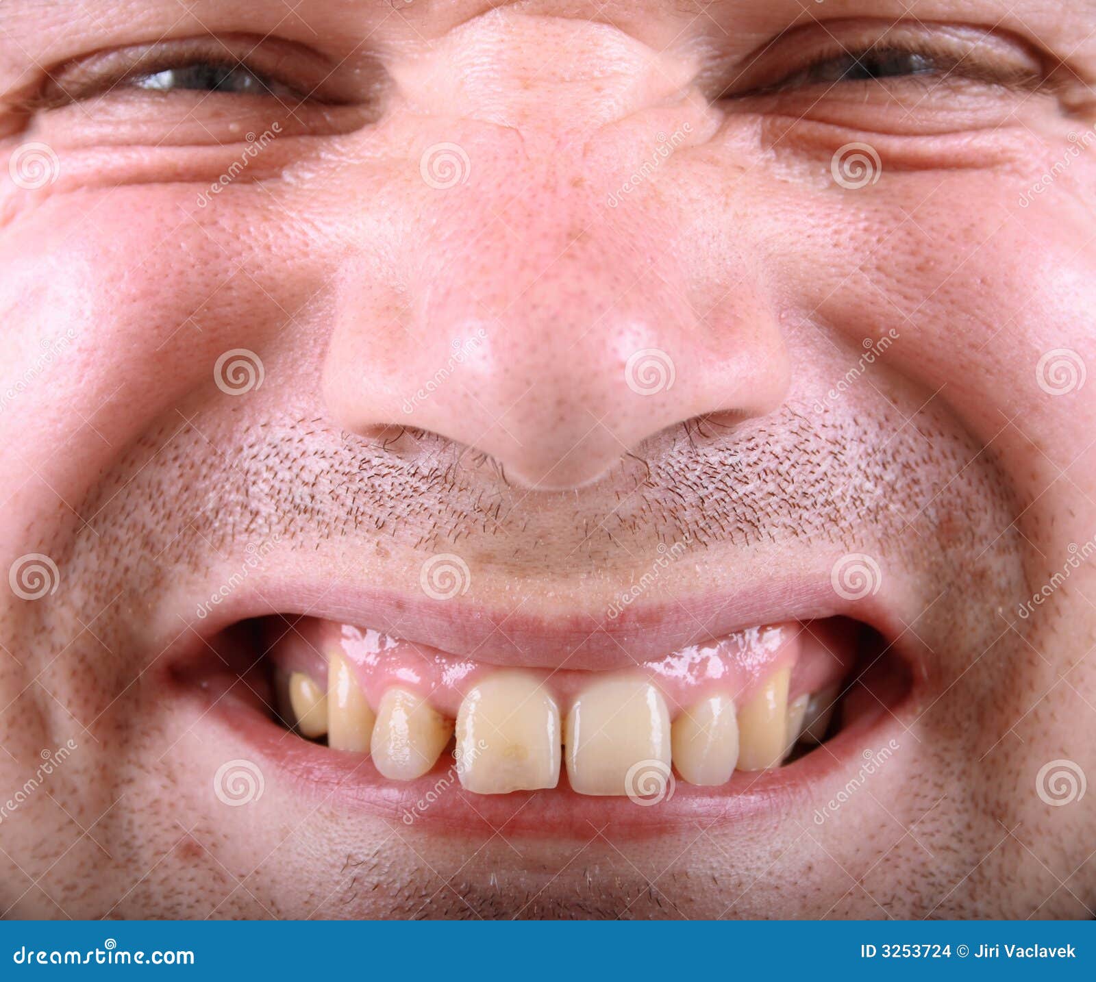 Ugly man stock photo. Image of white, dentist, loll, raiser - 3253724