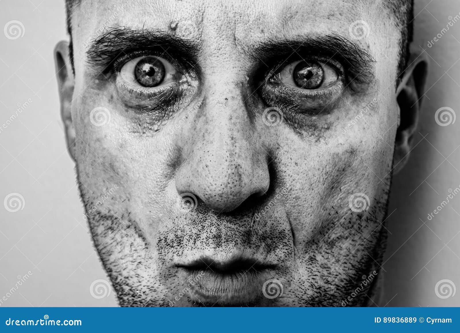 Ugly Man Portrait with Unshaven Face, Dirty Skin, Big Nose with Black ...
