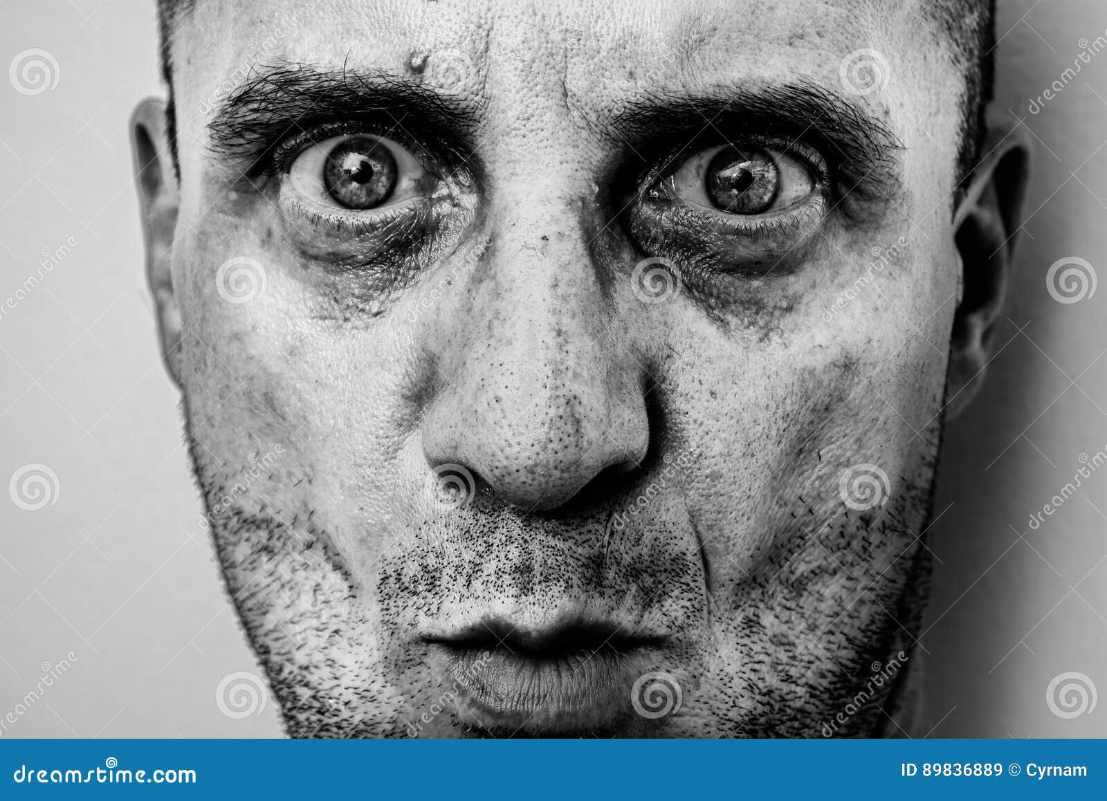 Ugly Man Portrait with Unshaven Face, Dirty Skin, Big Nose with Black Spots, Terrific Big Eyes Stock Image - Image of adult, looking: 89836889 Ugly Man Portrait with Unshaven Face, Dirty Skin, Big Nose with Black Spots, Terrific Big Eyes Stock Image - Image of adult, looking: 89836889