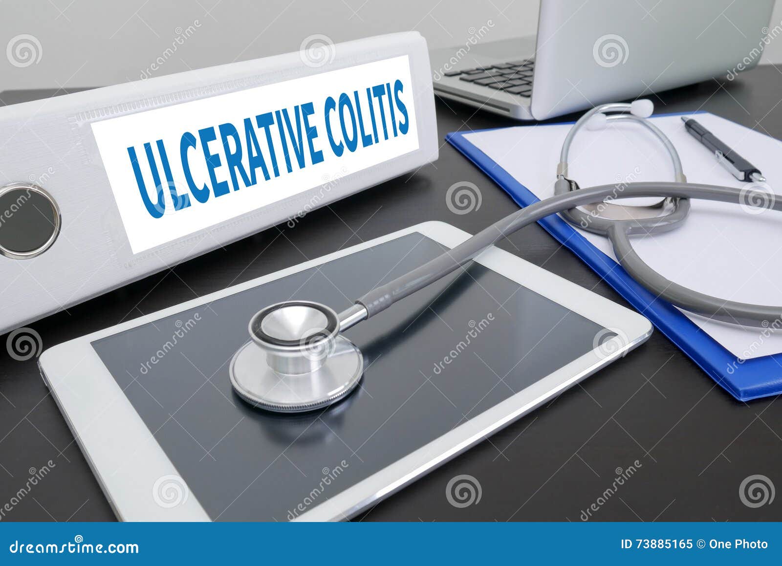 ulcerative colitis