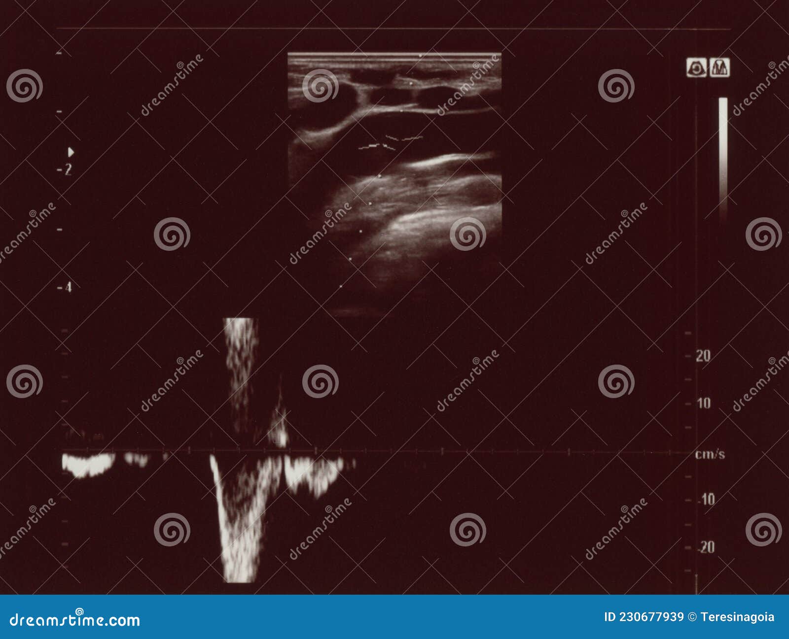 ultrasonic diagnostic sonography