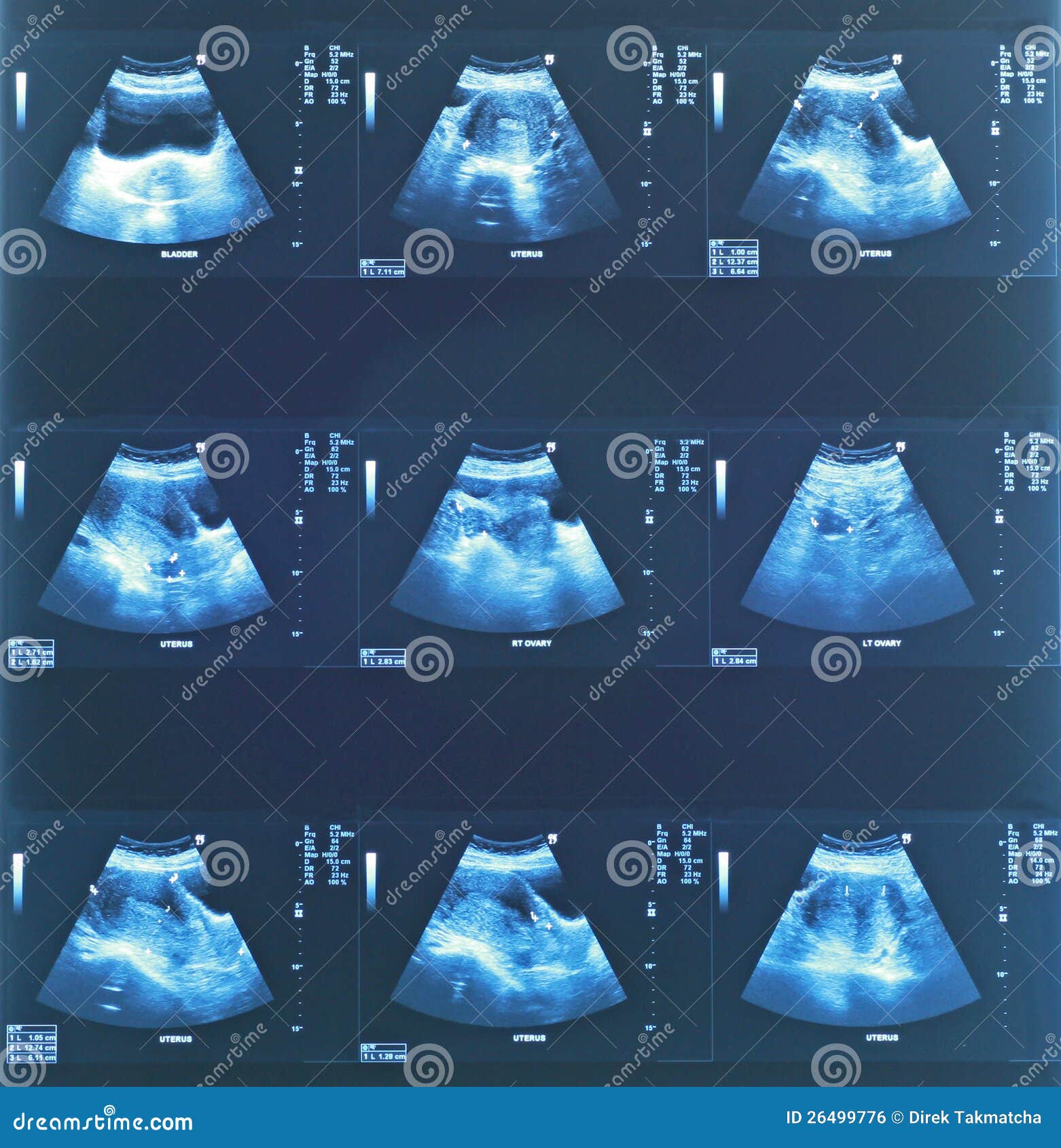 Ultrasound baby stock photo. Image of infant, imaging 26499776