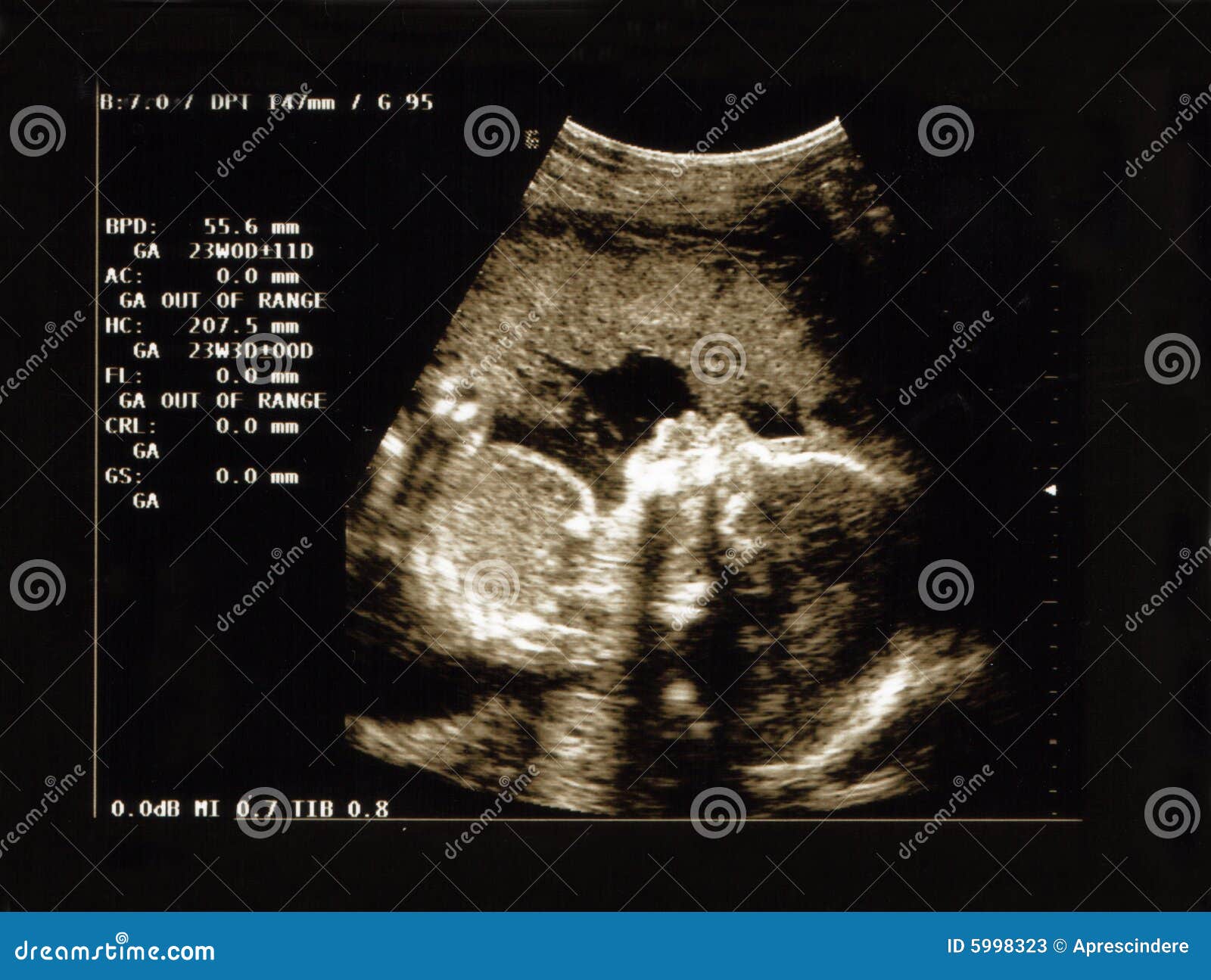 ultrasound portrait