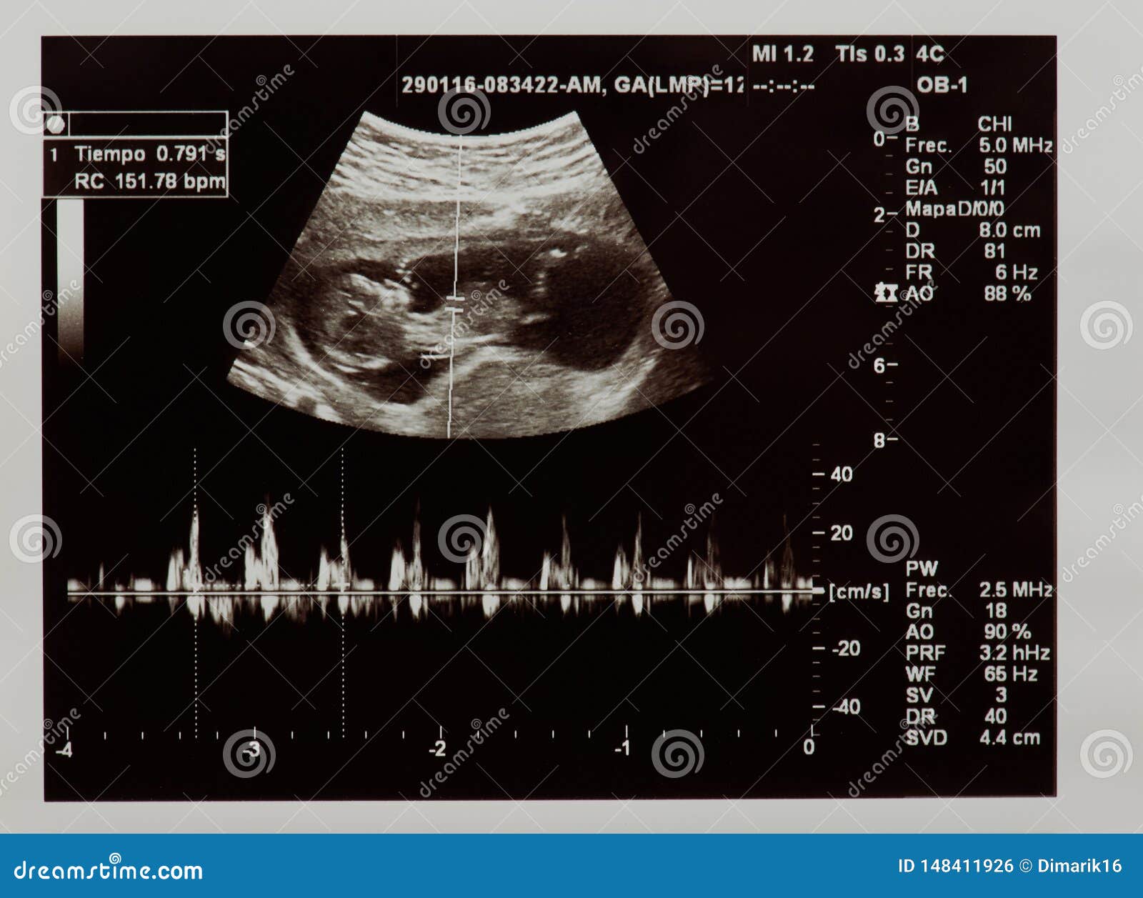 6,927 Ultrasound Scan Baby Stock Photos Free & Royalty-Free Stock Photos from