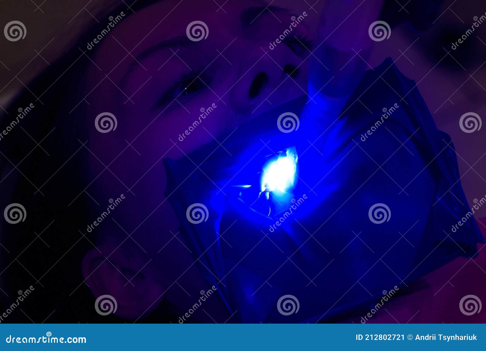 Ultraviolet Light in Dentistry, Treatment of Upper Masticatory Teeth