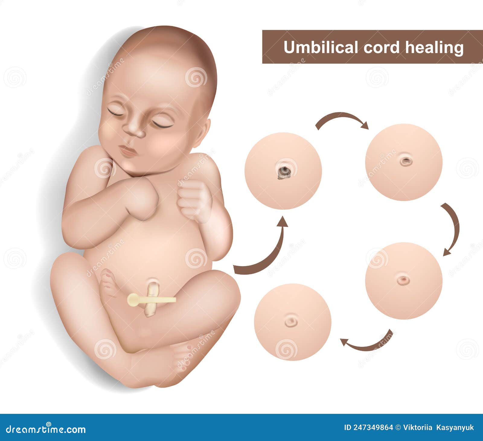 healthy umbilical cord stump