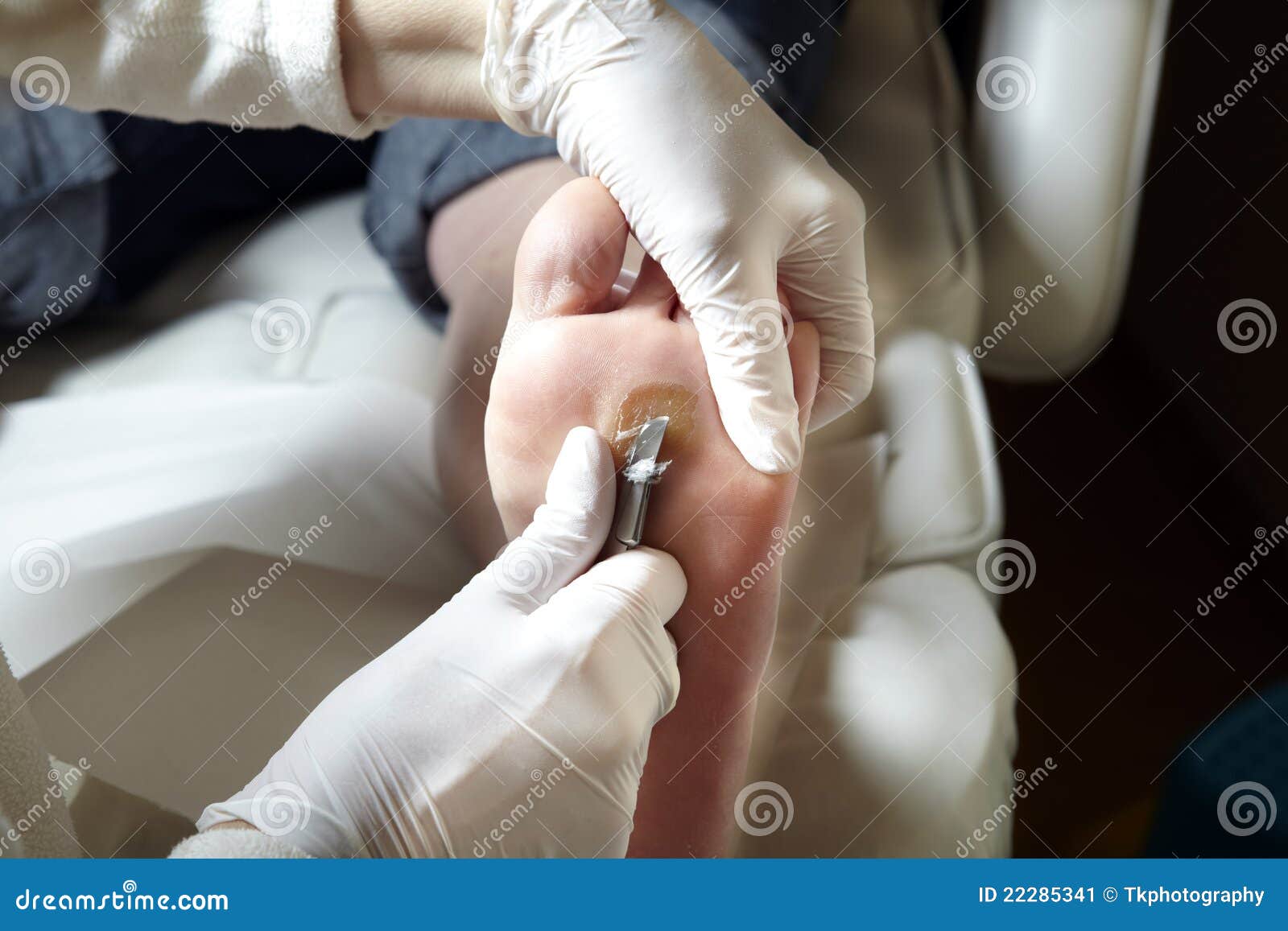 Un Pédicure Travaille Avec Un Scalpel Image stock - Image du masque,  unique: 22285341