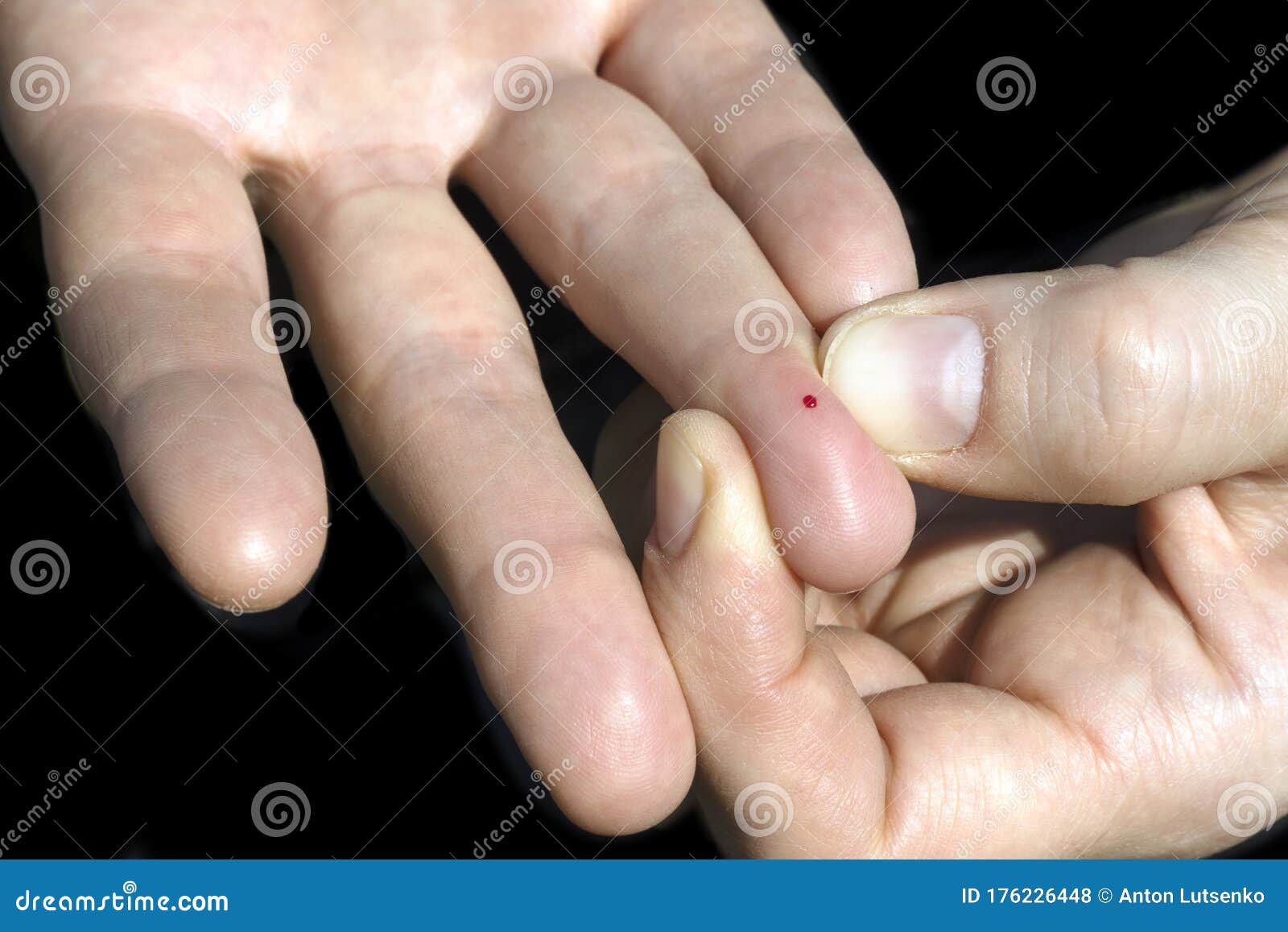 Una Gota De Sangre En Un Dedo Y Una Herida De Una Inyección Foto de Imagen de hembra, puntura: