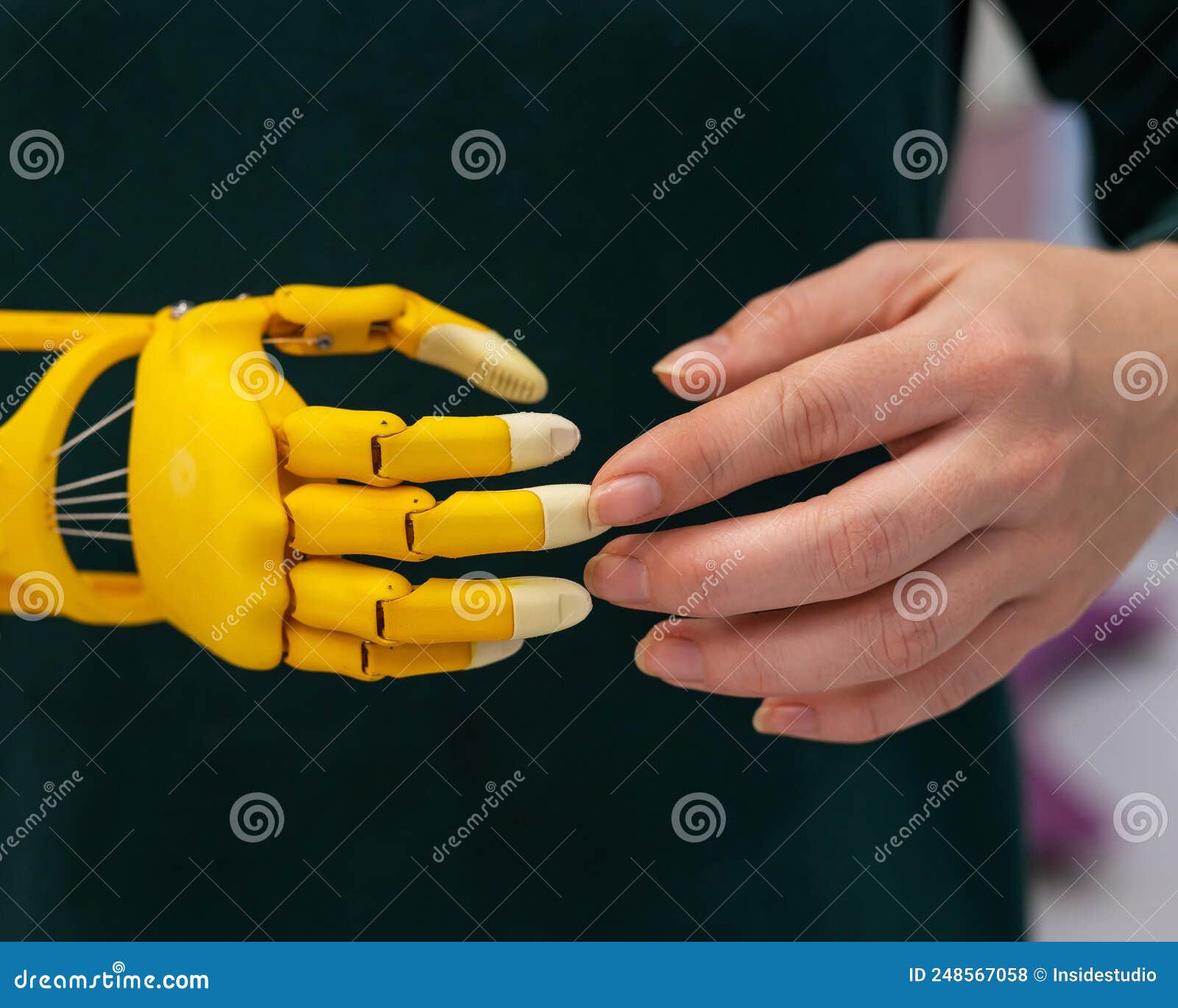 Une Femme Montre Une Main Prothèse Enfant En Plastique Imprimée Sur Une  Imprimante 3d. Photo stock - Image du santé, incorrect: 248567058