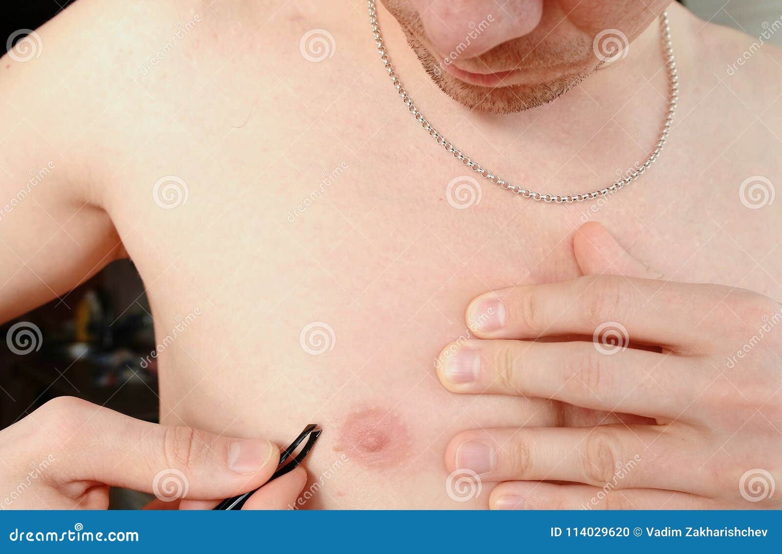 шарик на груди у мужчин фото 27