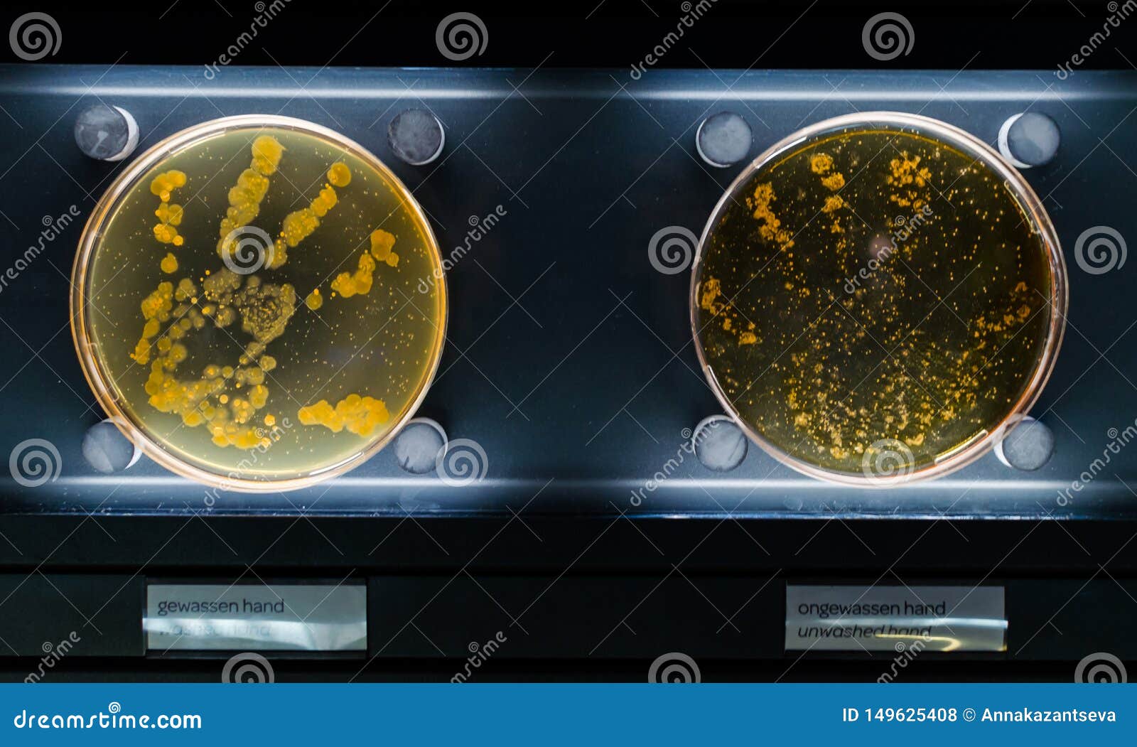 Unwashed and Washed Hand Bacterias in Petri Dish Stock Photo Image of