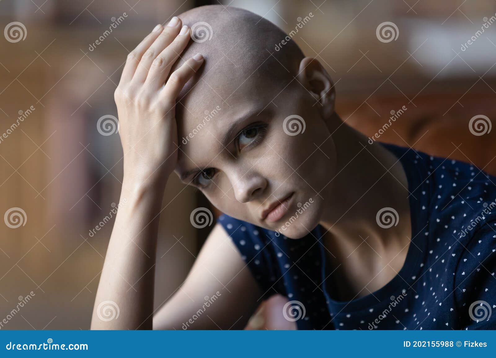 upset millennial woman having cancer diagnosis touching hairless head