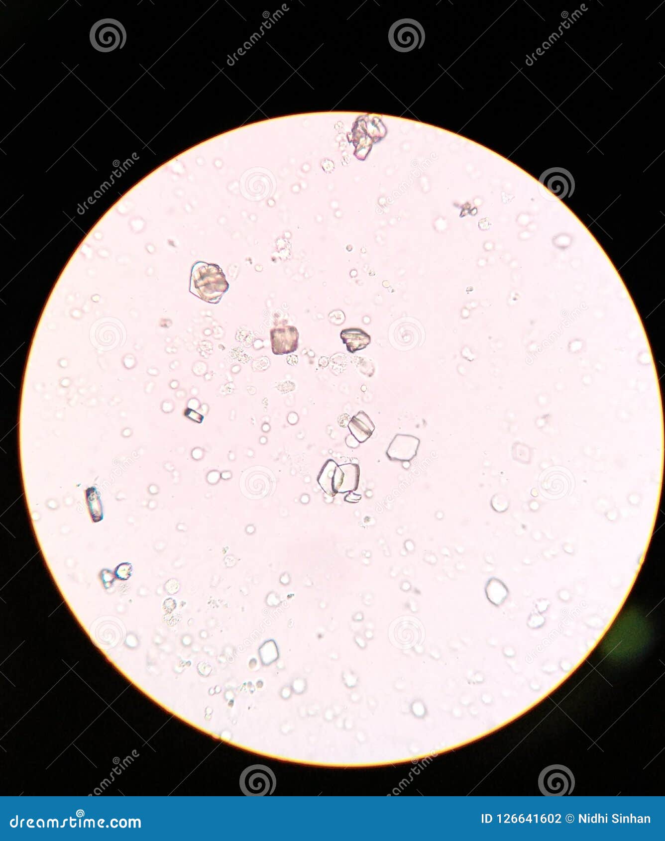 Acid uric (în urina nictimerală) - Invitro Diagnostics