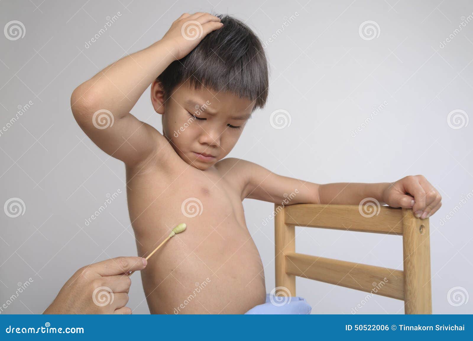 Uricaria Treten Im Kinderkörper Auf Stockfoto - Bild von kratzer, allergie:  50522006