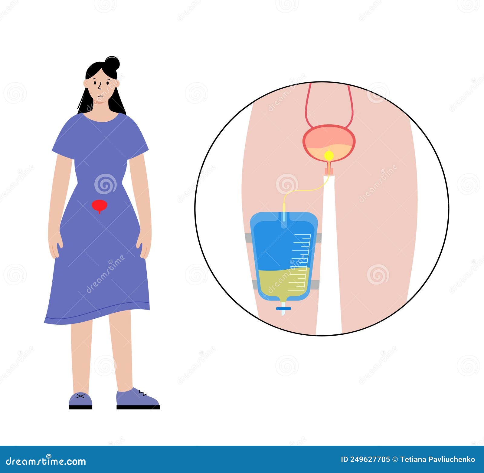 Silicone Urine Receiver Male Elderly Paralyzed Leak-proof Elderly Bedridden  Urinal Adult Urine Bag Female Catheter - Urological Consumables - AliExpress