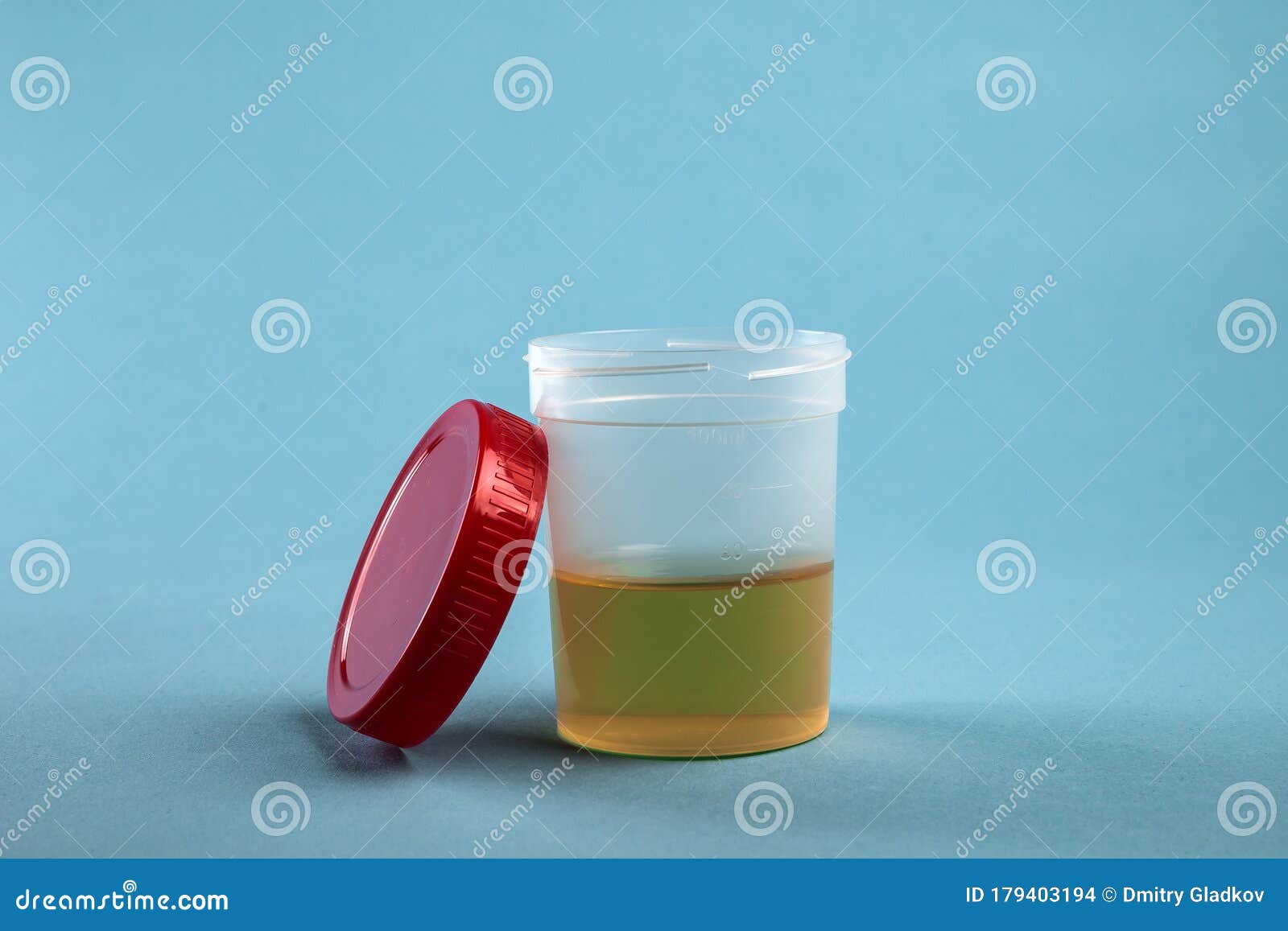 Urine Analysis for a Test in Plastic Jar Stock Photo Image of exam, container 179403194